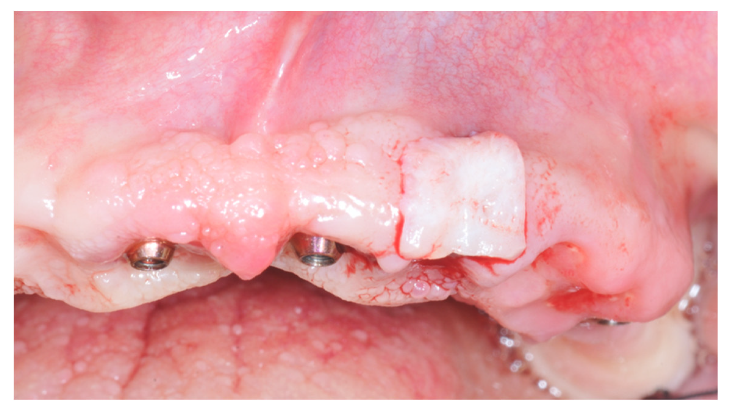 Prosthesis 04 00020 g006 Prosthesis 04 00020 g006
