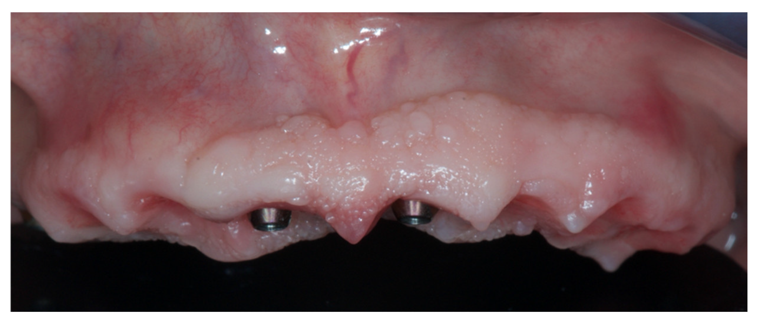 Prosthesis 04 00020 g007 Prosthesis 04 00020 g007