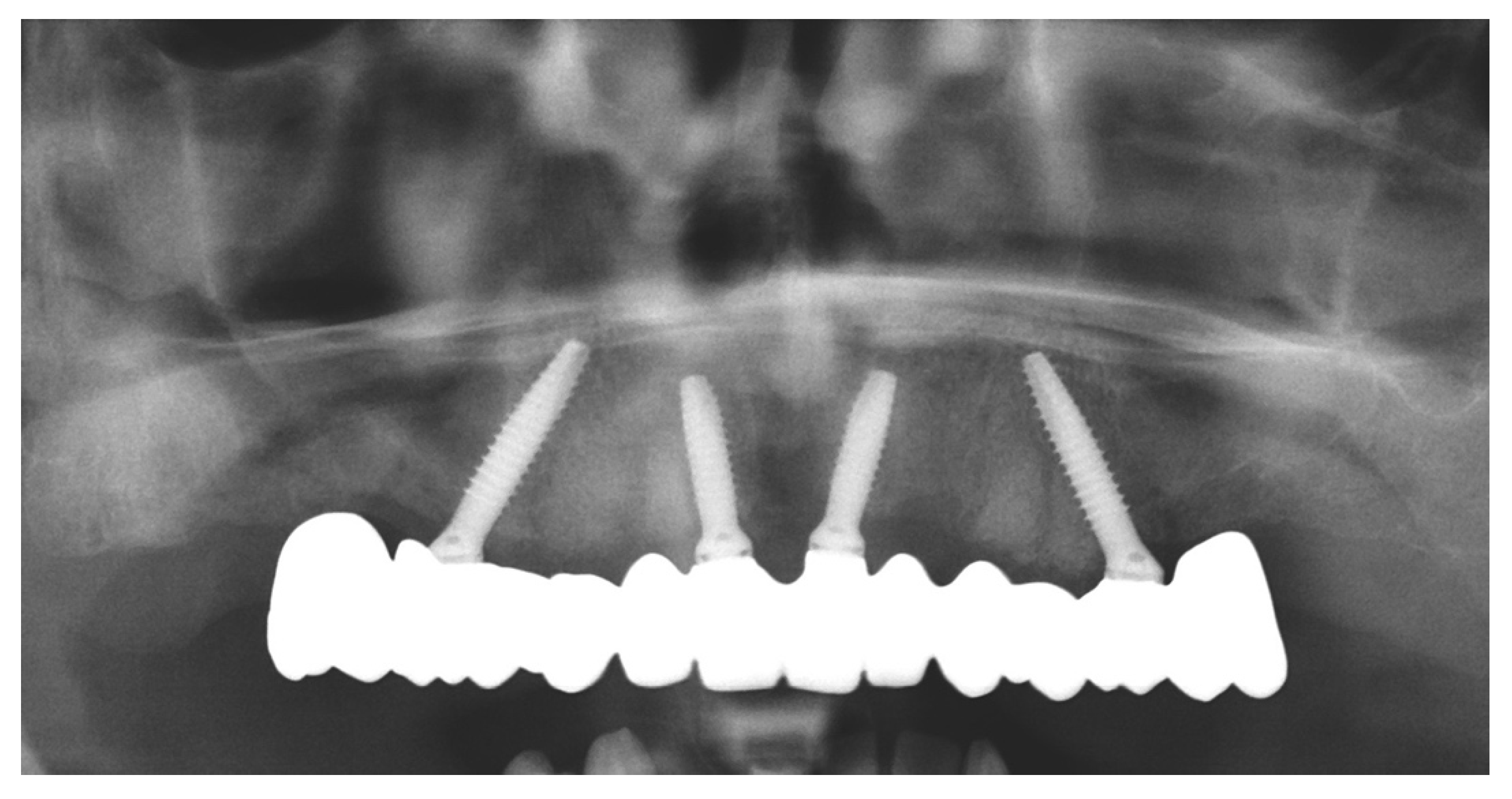 Prosthesis 04 00020 g009 Prosthesis 04 00020 g009