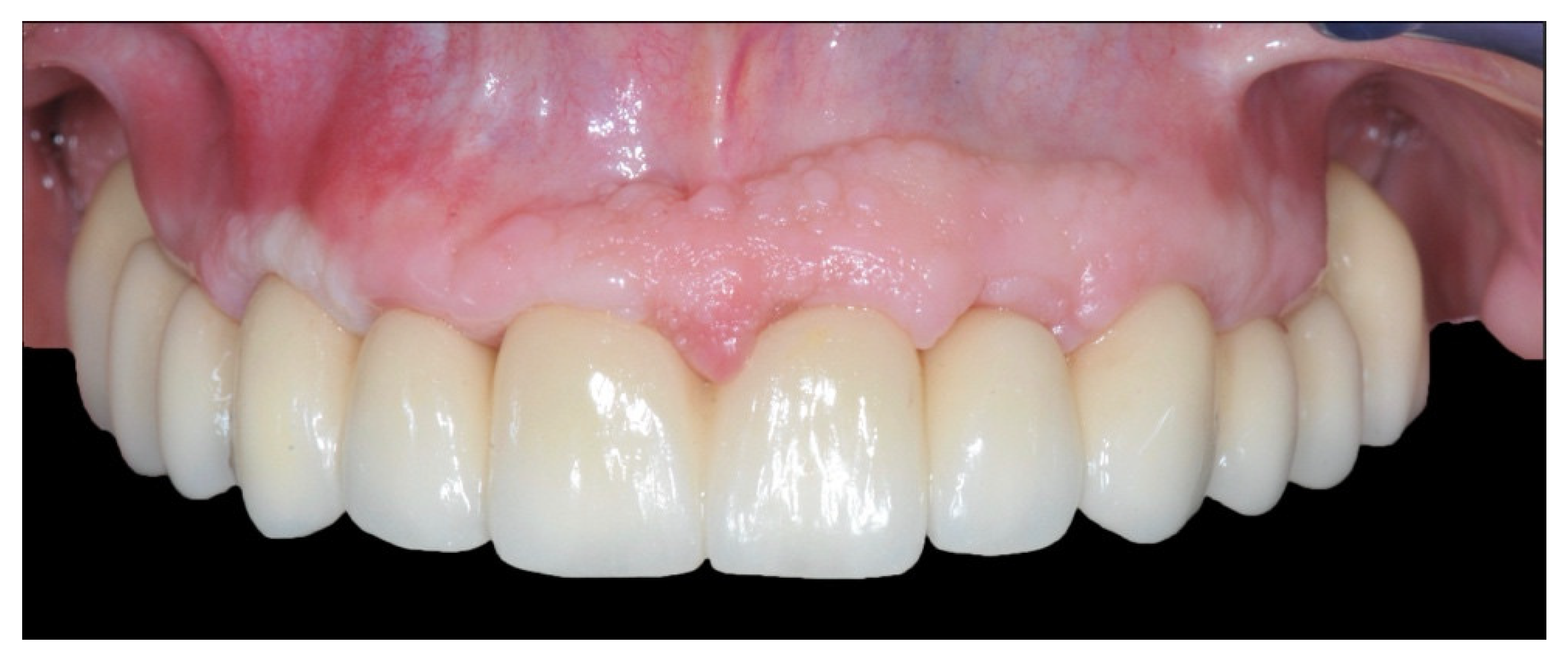 Prosthesis 04 00020 g010 Prosthesis 04 00020 g010