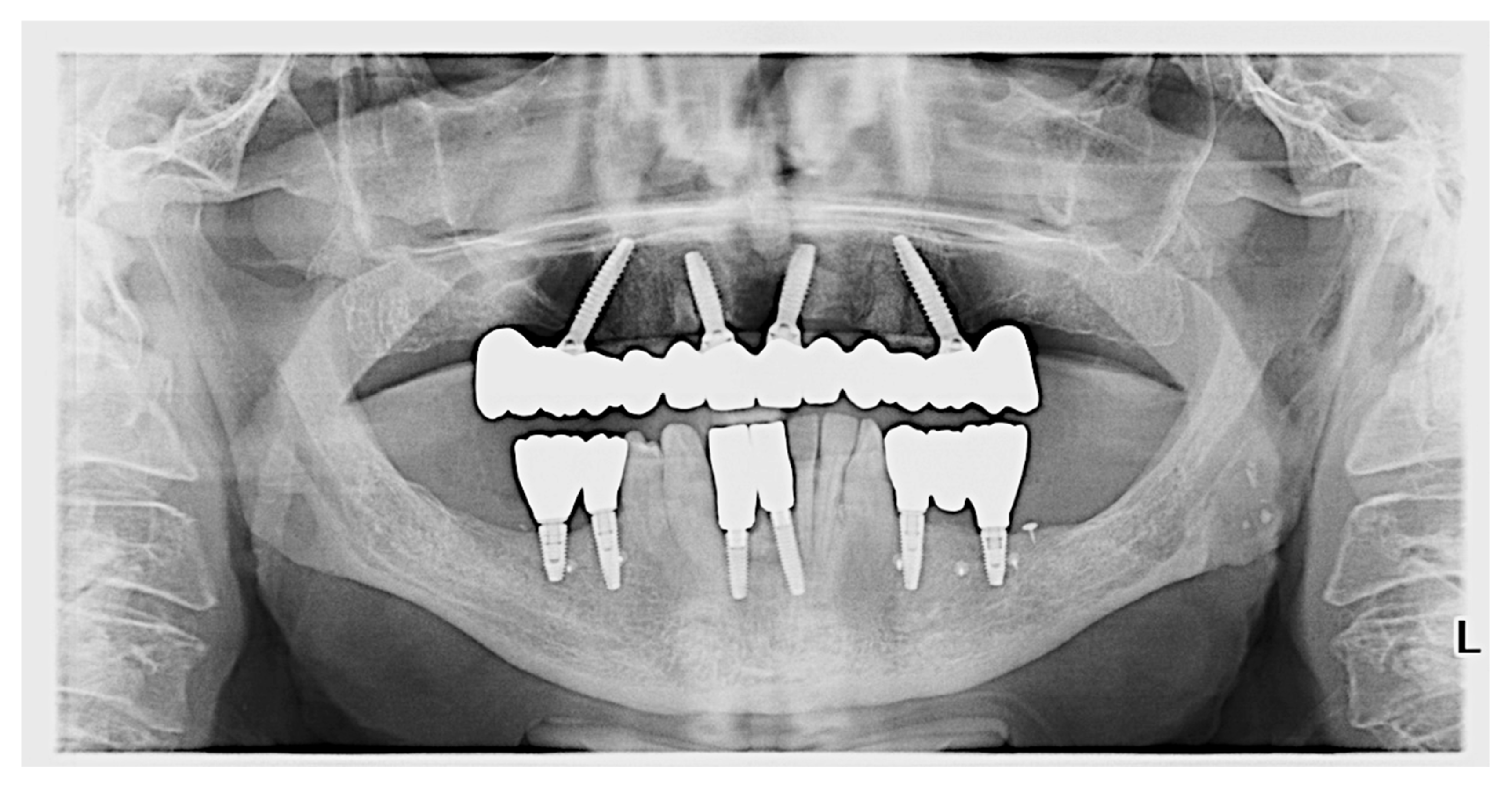 Prosthesis 04 00020 g011 Prosthesis 04 00020 g011