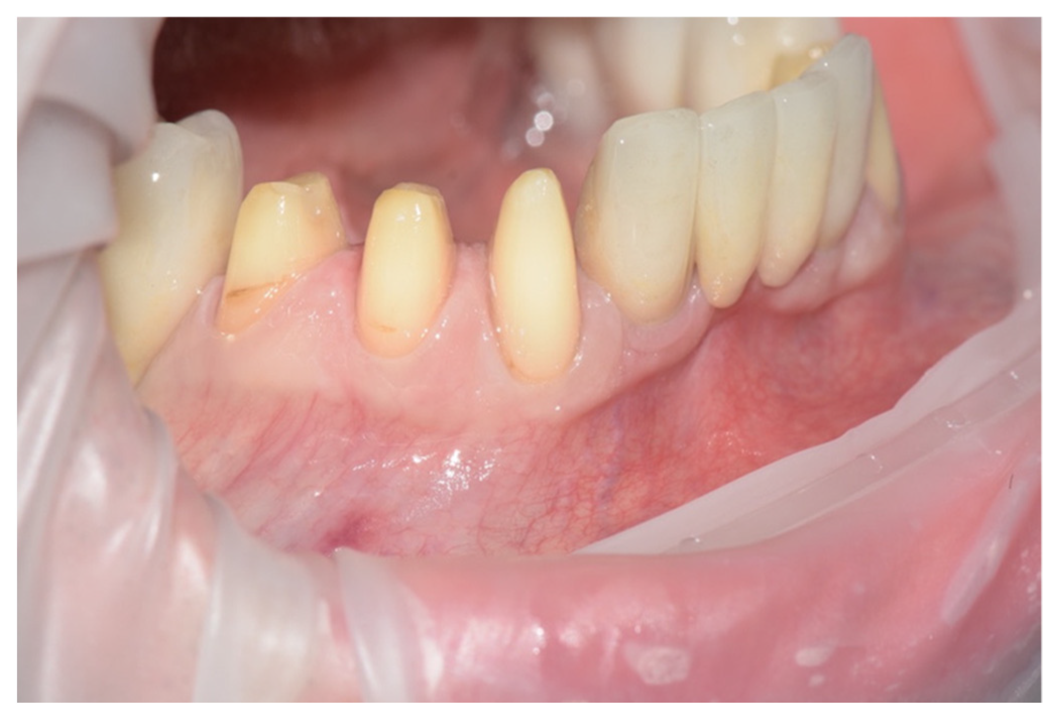 Prosthesis 04 00023 g002