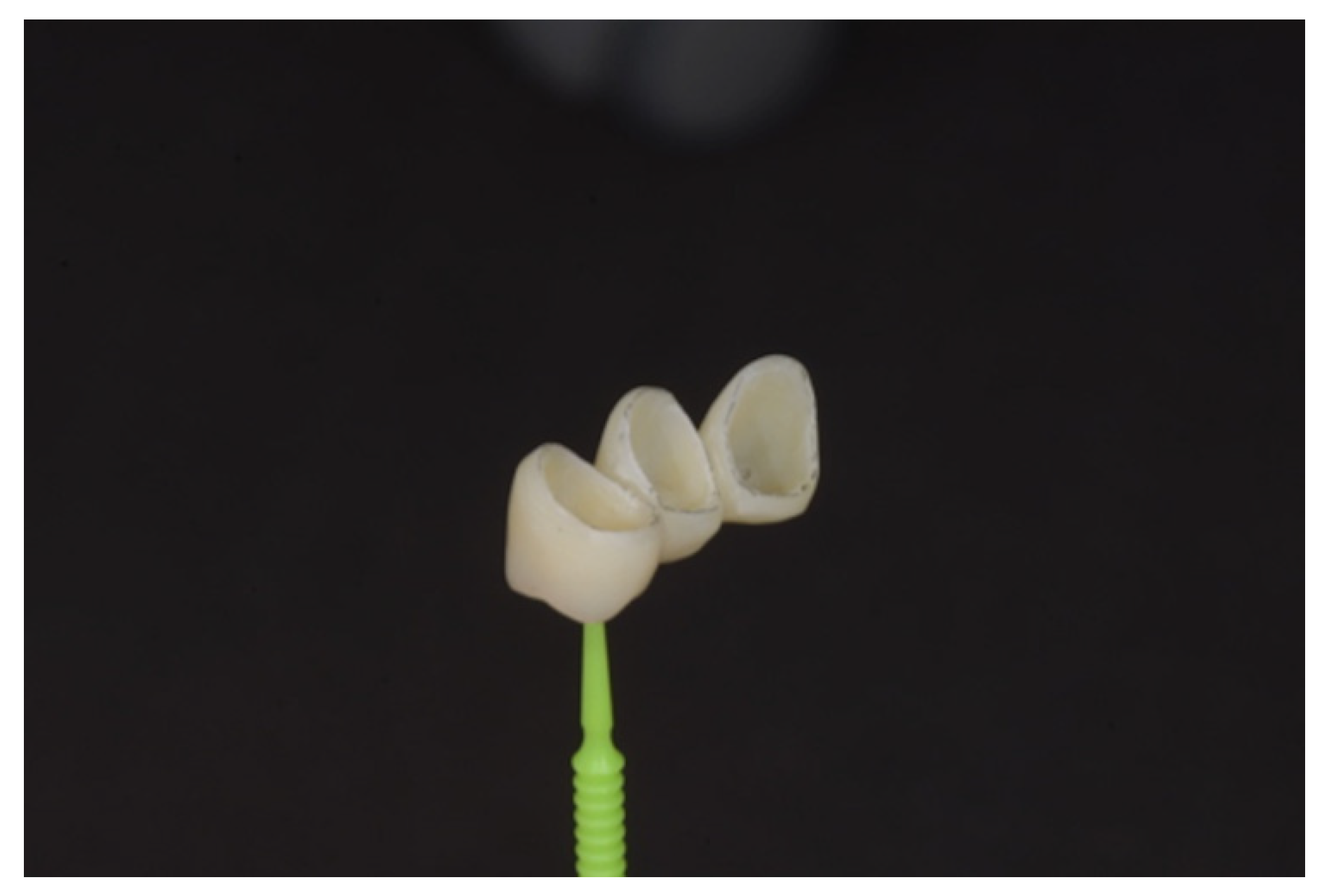 Prosthesis 04 00023 g003