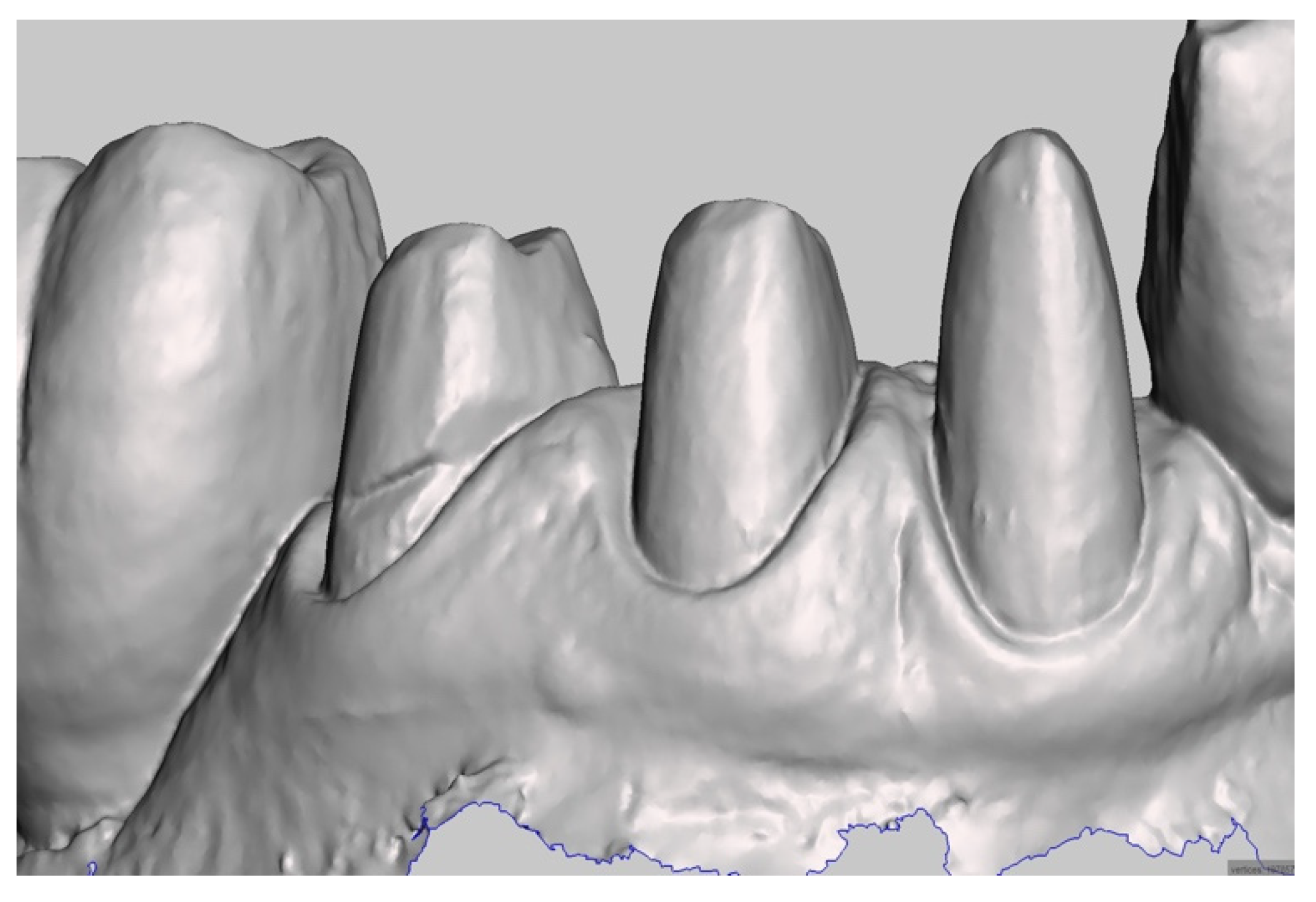 Prosthesis 04 00023 g004