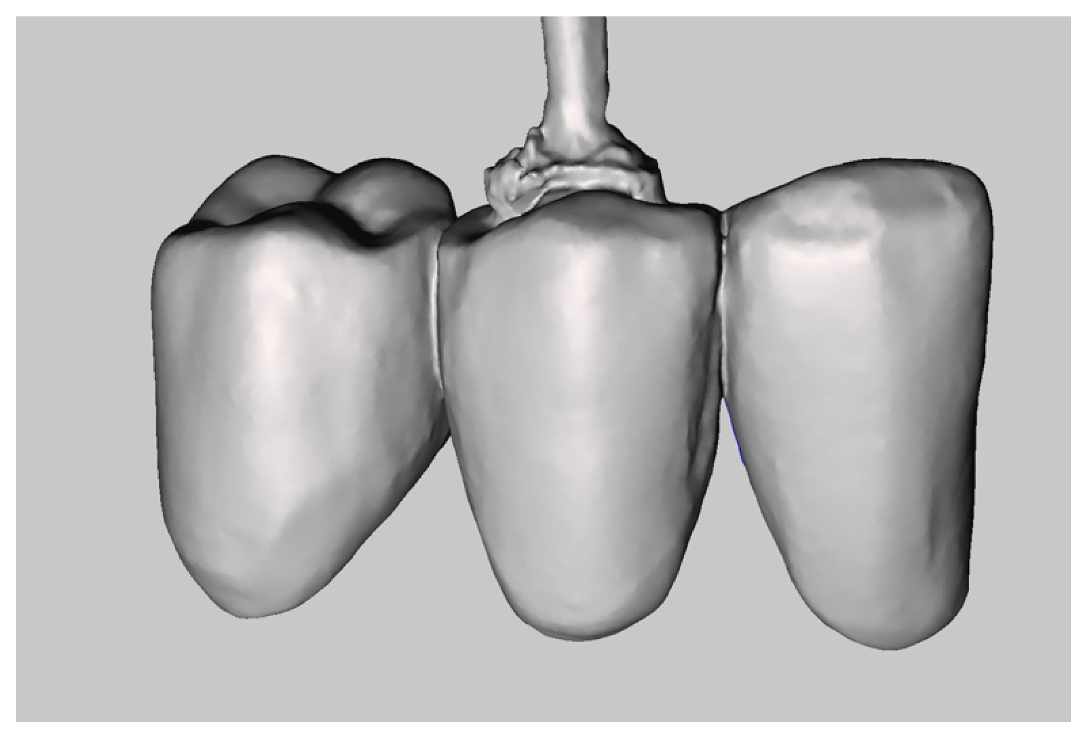 Prosthesis 04 00023 g005