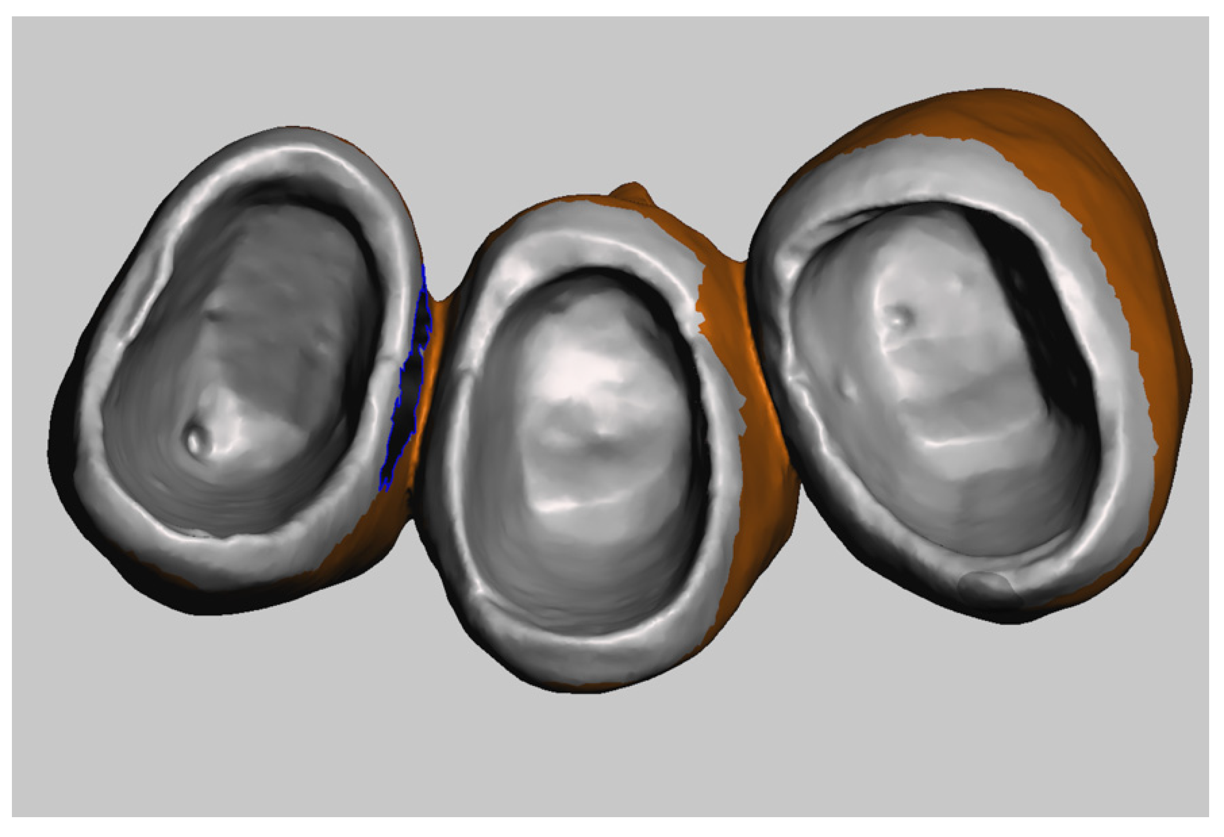 Prosthesis 04 00023 g008