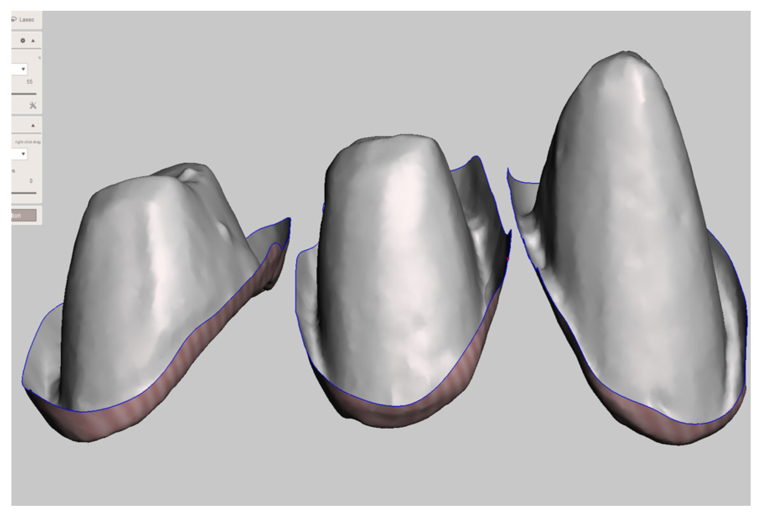 Prosthesis 04 00023 g009