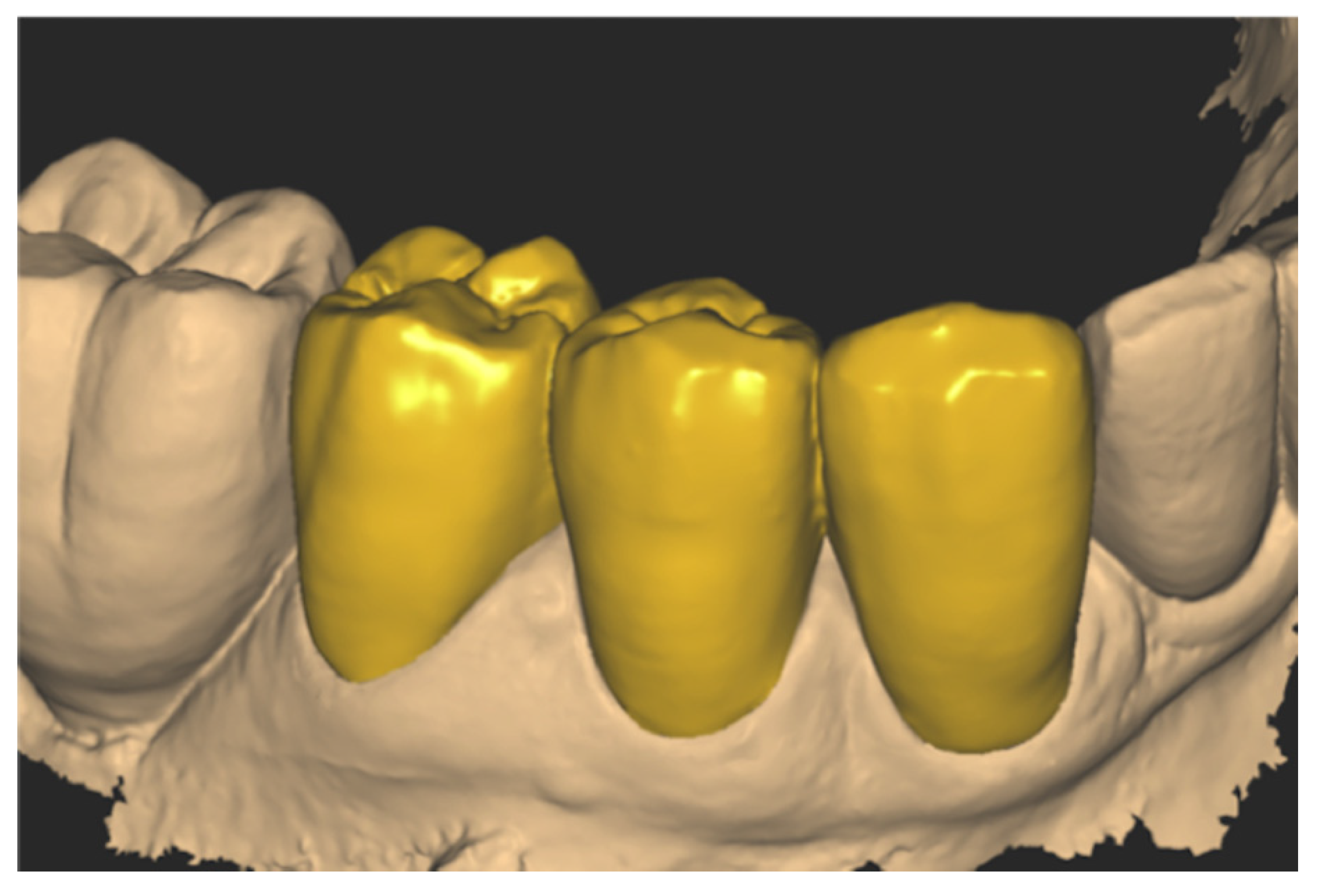 Prosthesis 04 00023 g016