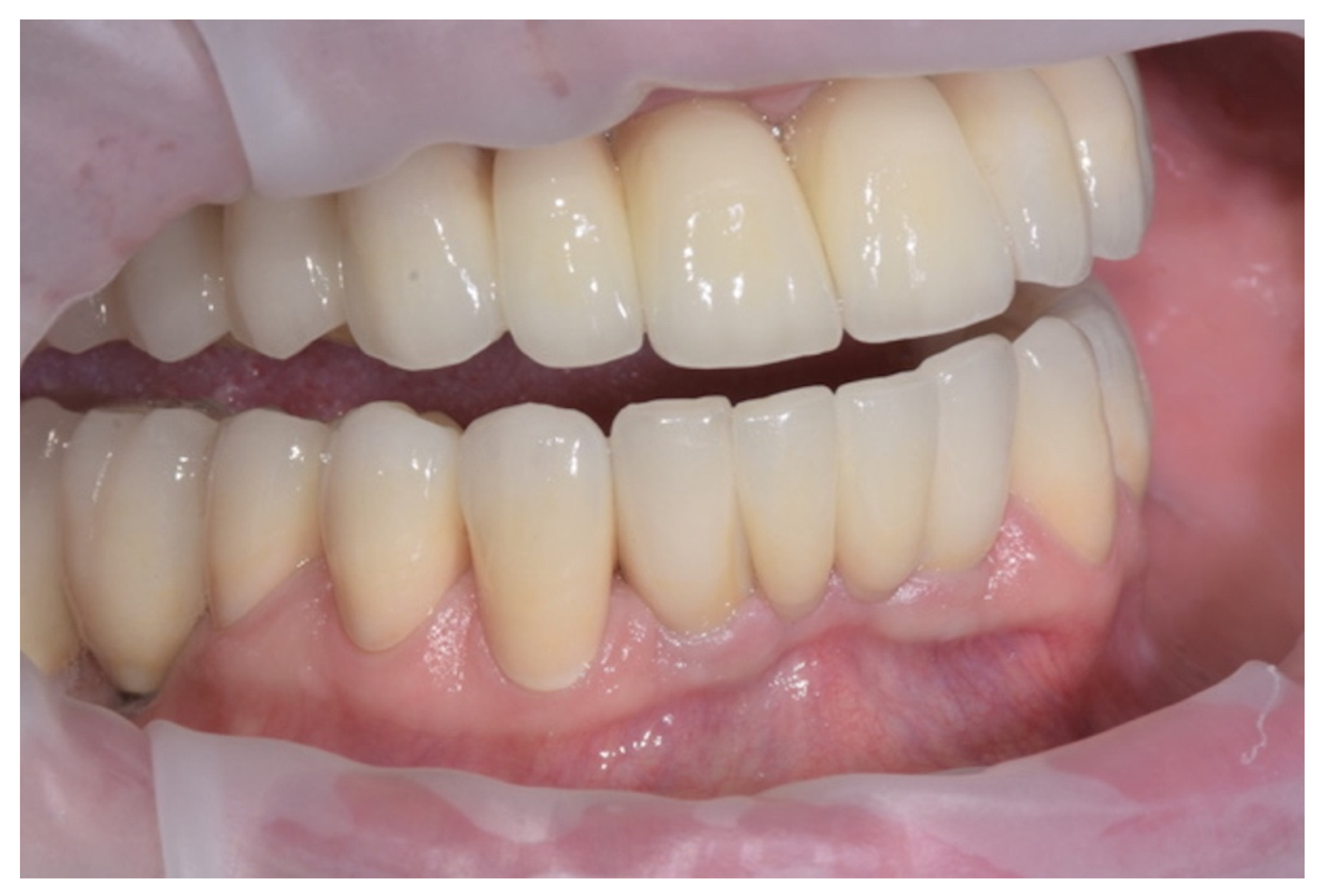 Prosthesis 04 00023 g017