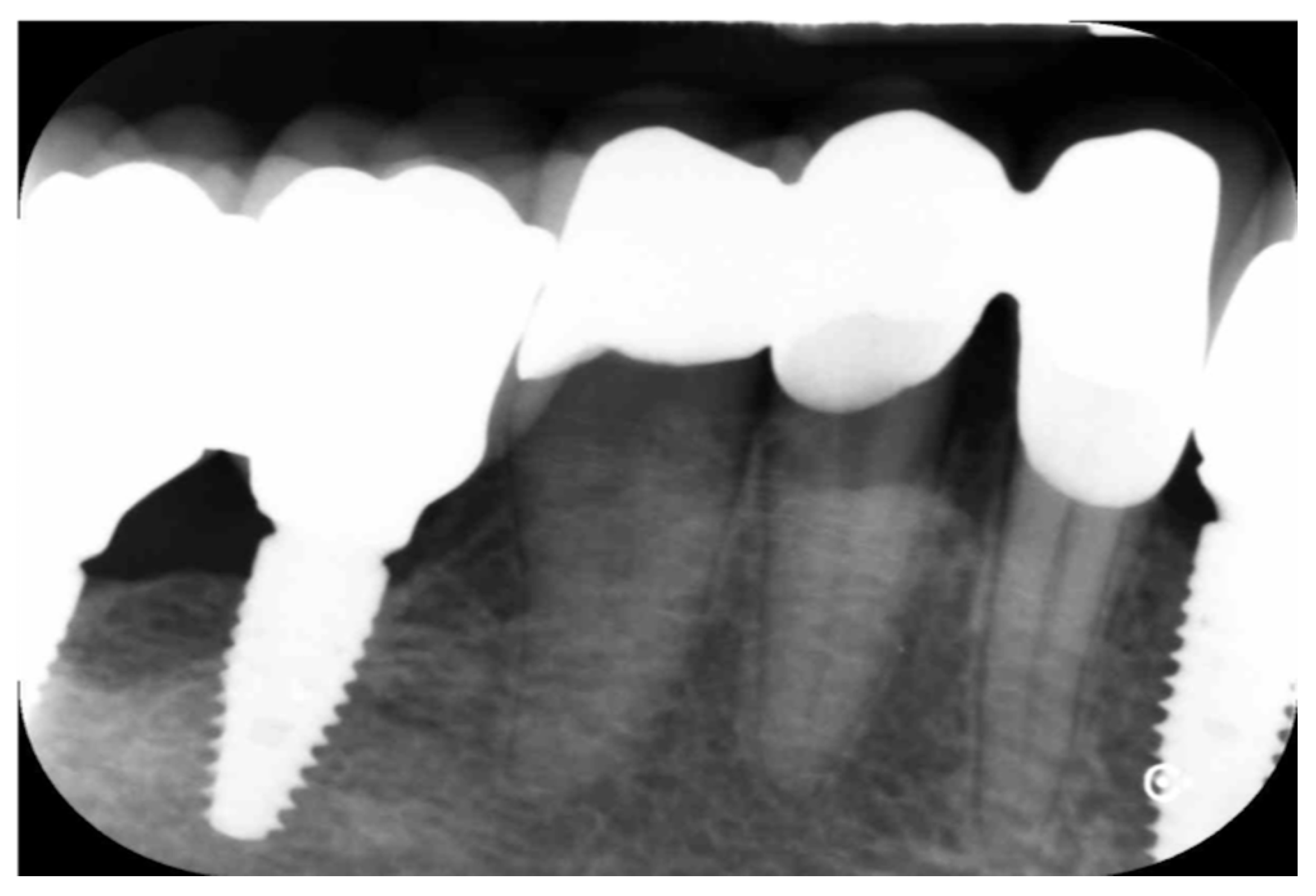 Prosthesis 04 00023 g018