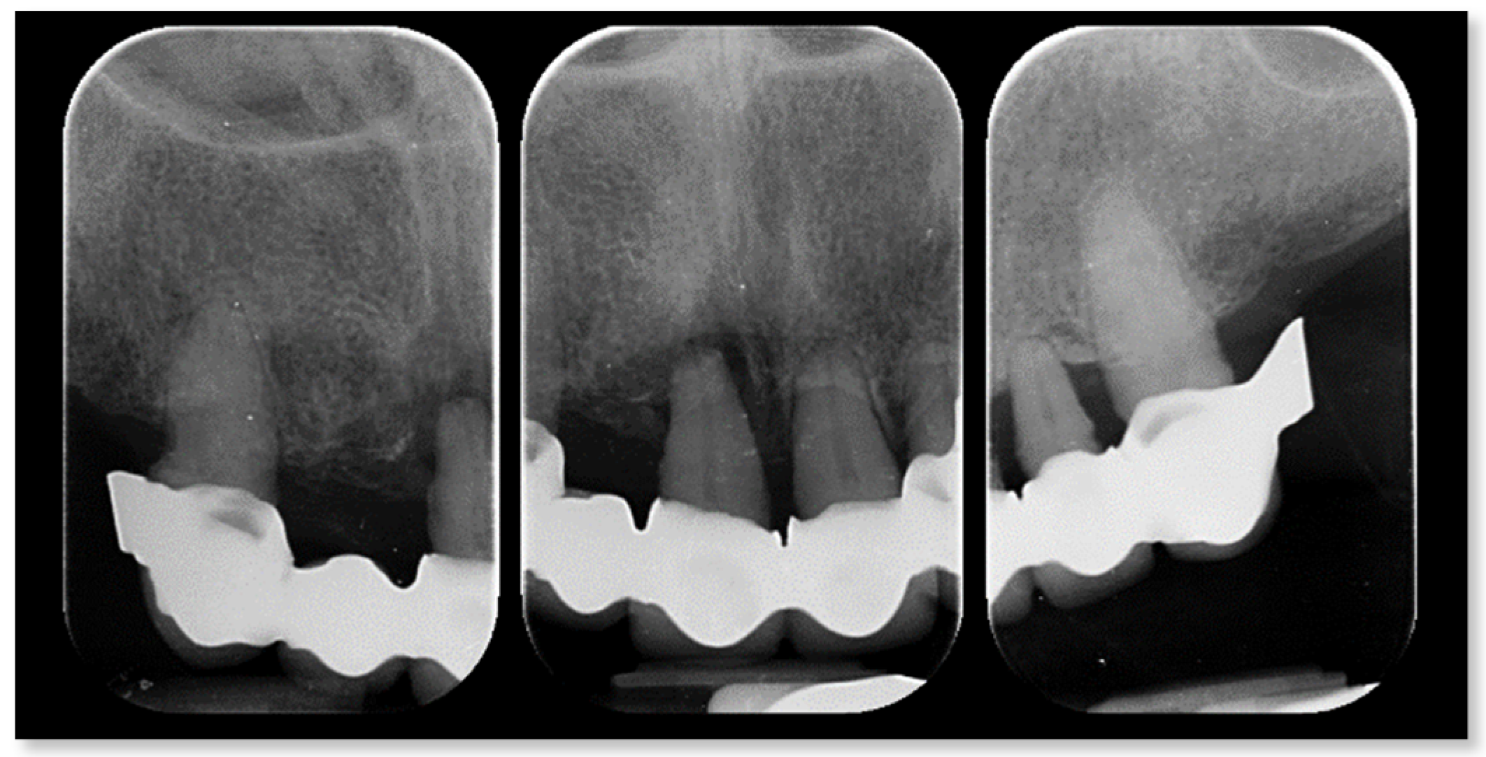 Prosthesis 04 00029 g002 Prosthesis 04 00029 g002