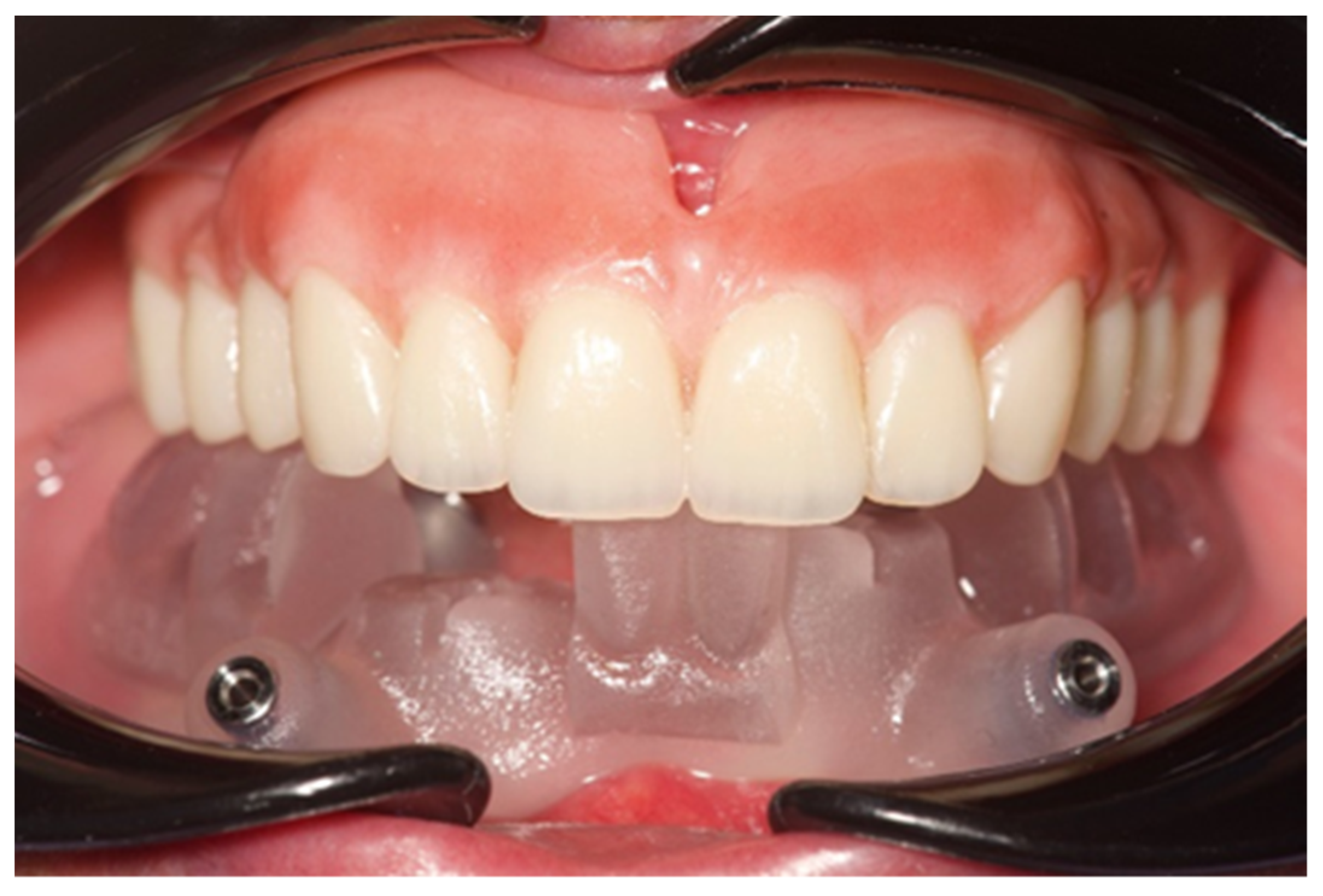 Prosthesis 04 00029 g005 Prosthesis 04 00029 g005