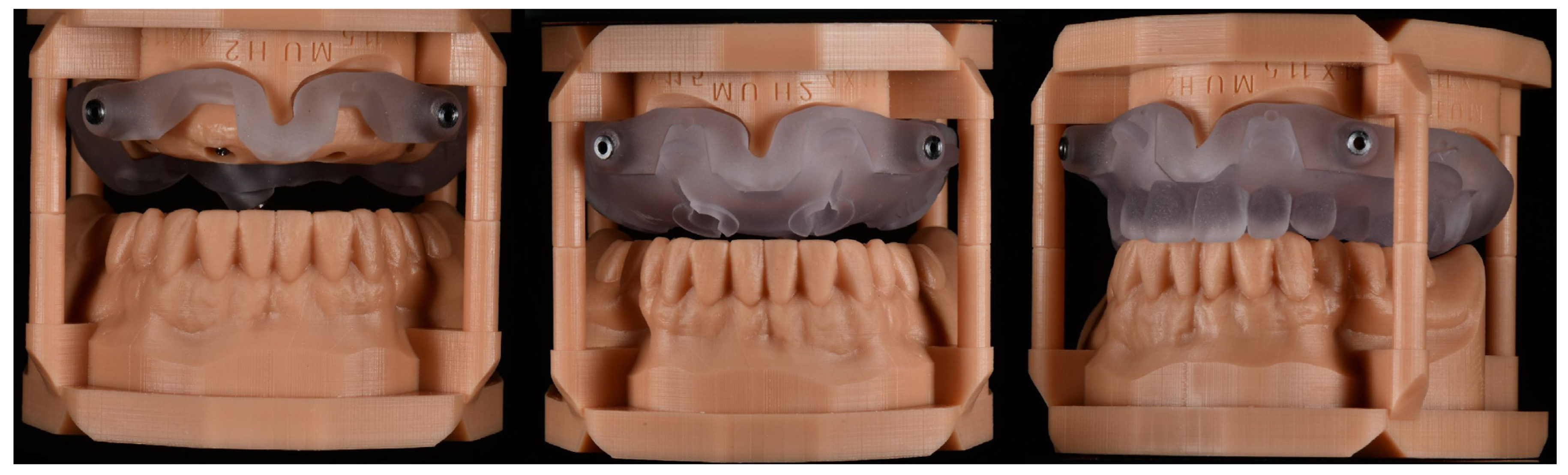 Prosthesis 04 00029 g008 Prosthesis 04 00029 g008