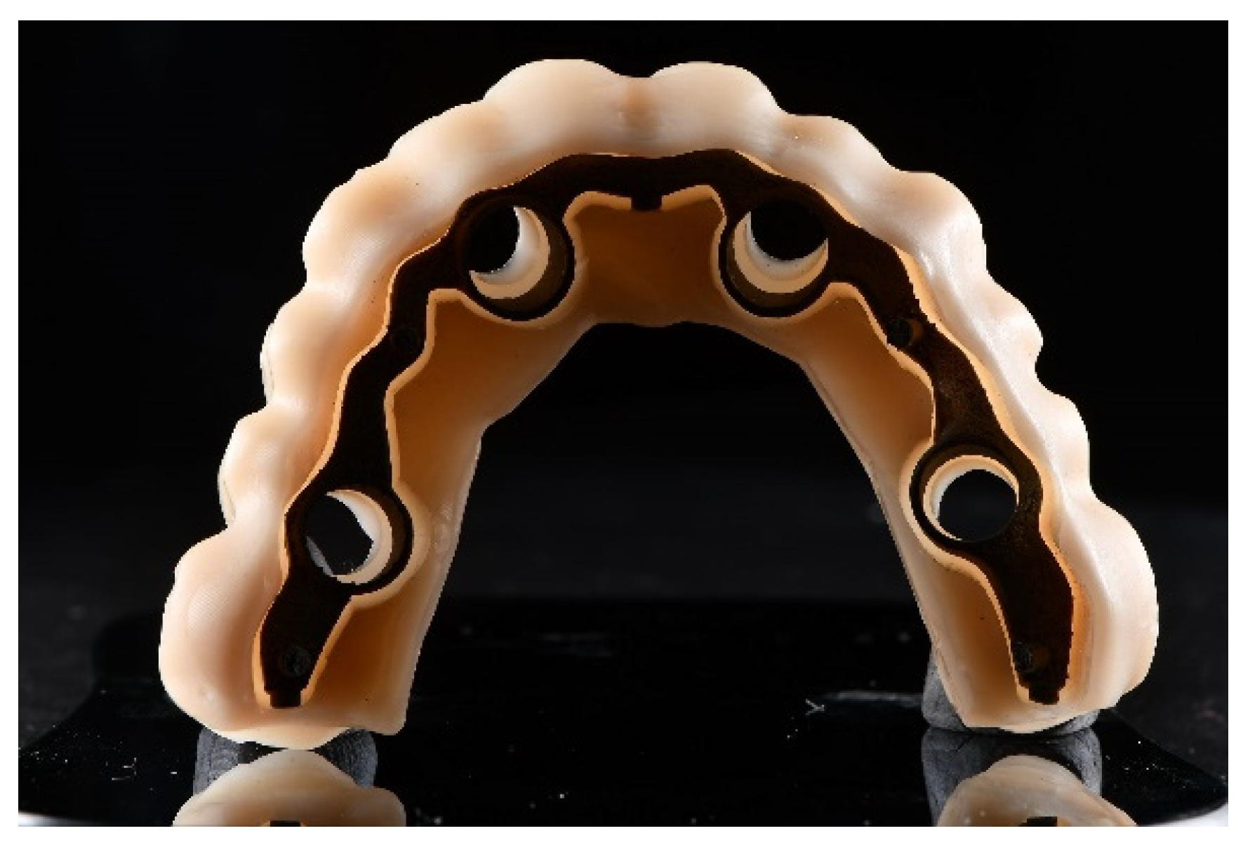 Prosthesis 04 00029 g009 Prosthesis 04 00029 g009