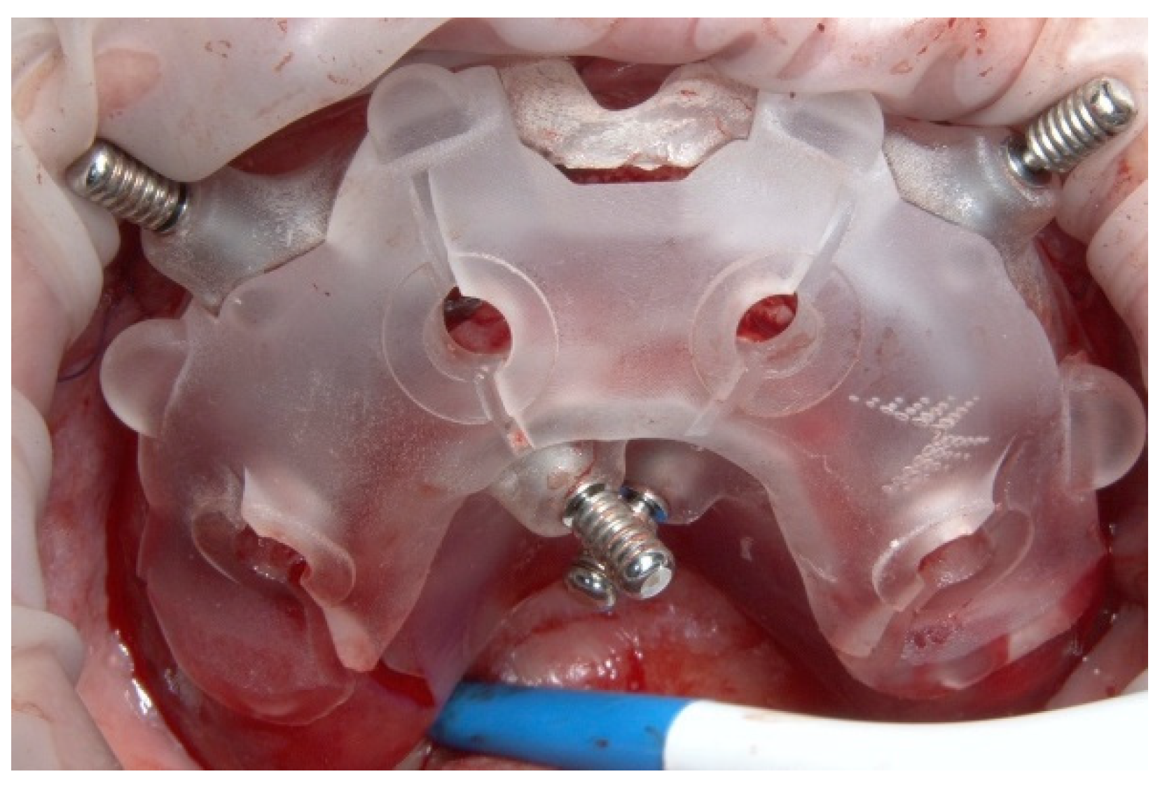 Prosthesis 04 00029 g011 Prosthesis 04 00029 g011