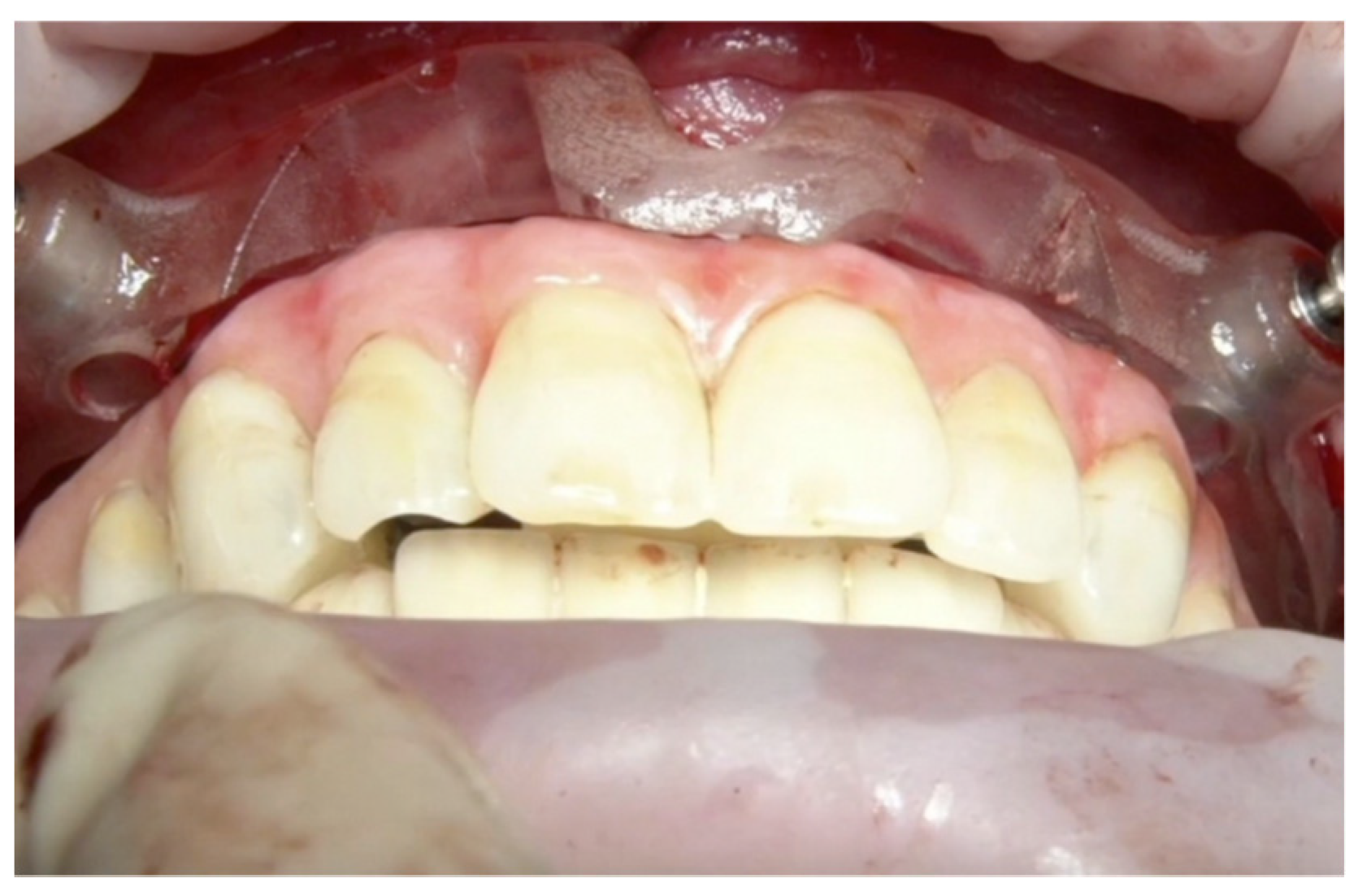 Prosthesis 04 00029 g012 Prosthesis 04 00029 g012