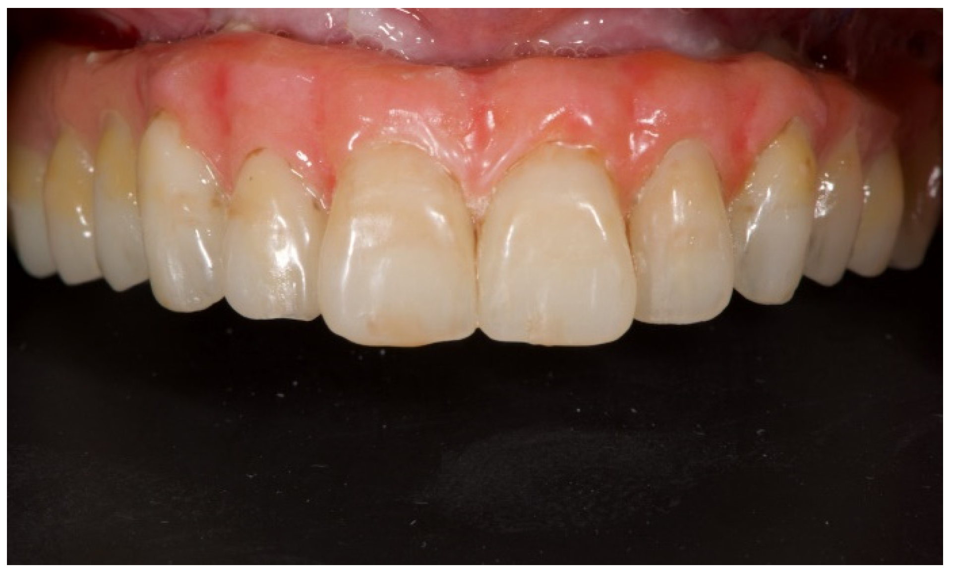 Prosthesis 04 00029 g013 Prosthesis 04 00029 g013