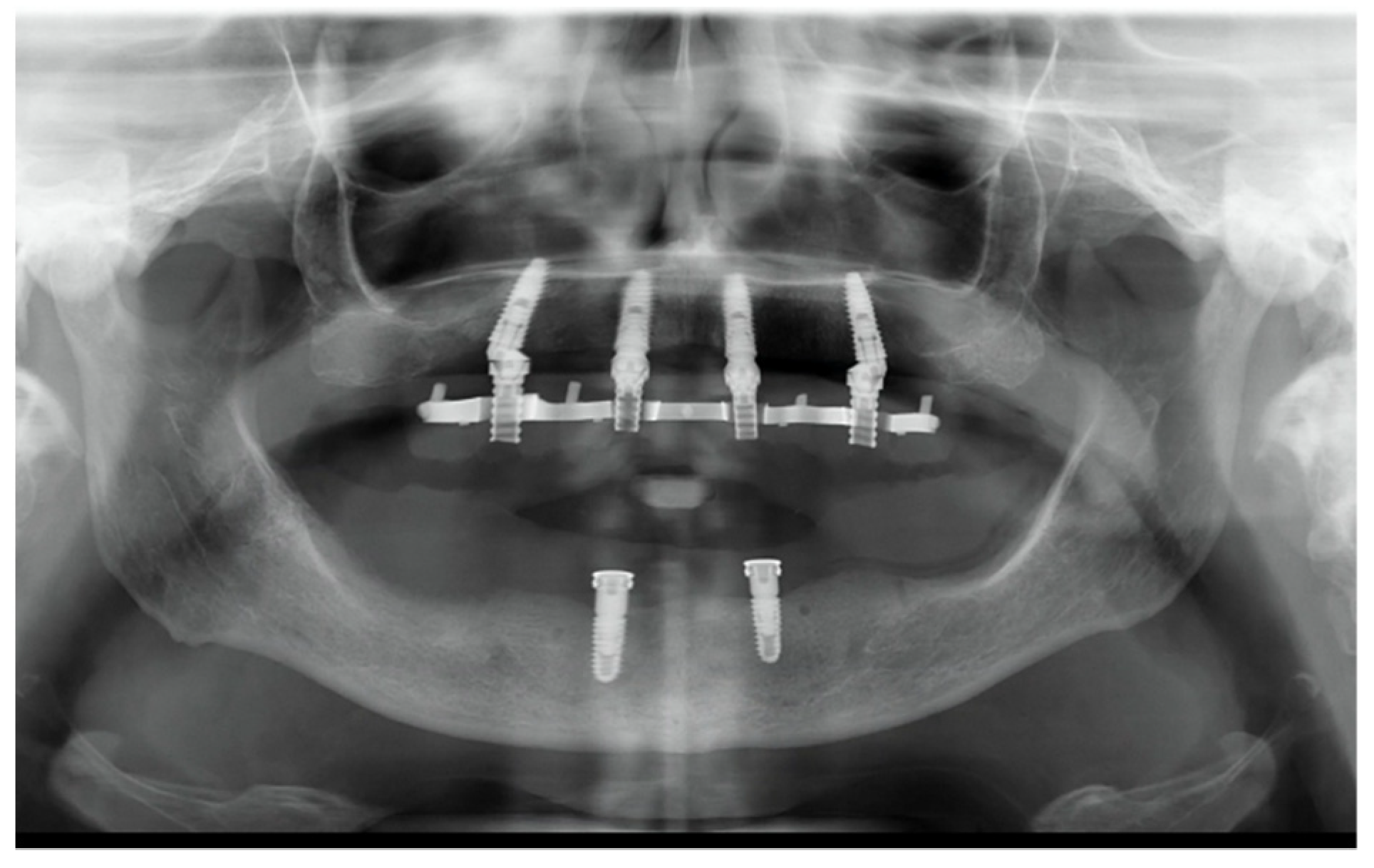 Prosthesis 04 00029 g014 Prosthesis 04 00029 g014