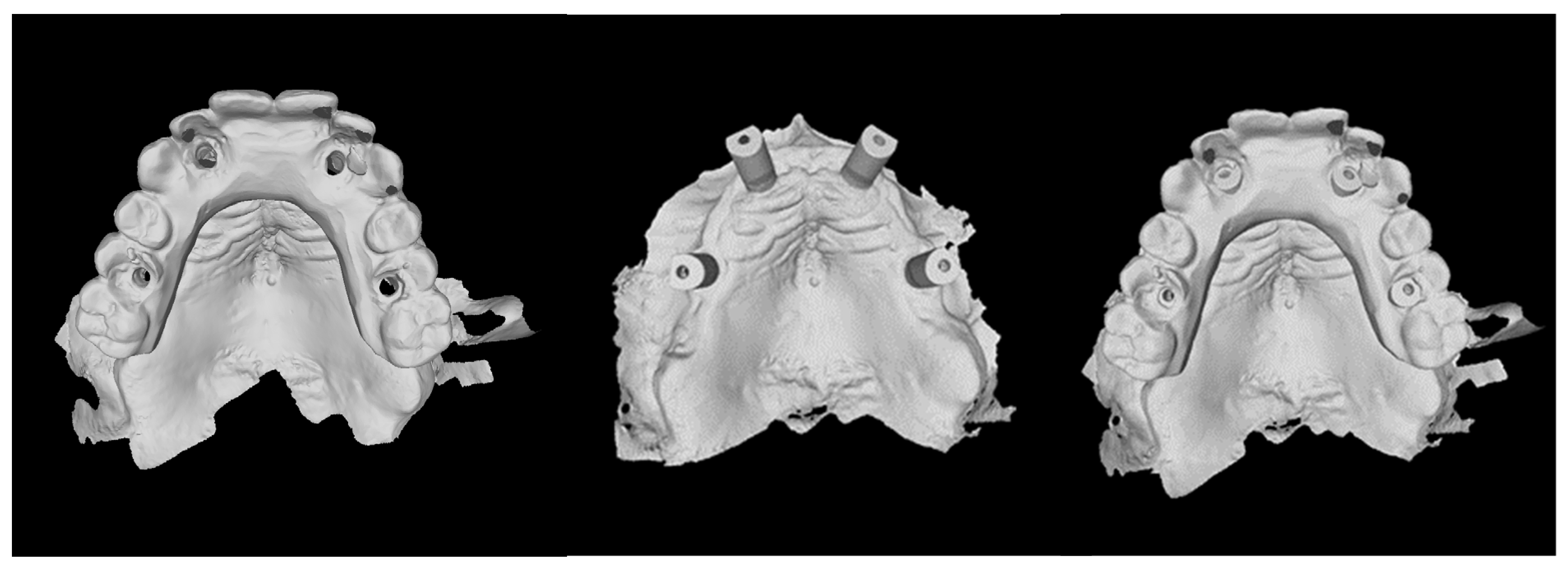 Prosthesis 04 00029 g018 Prosthesis 04 00029 g018