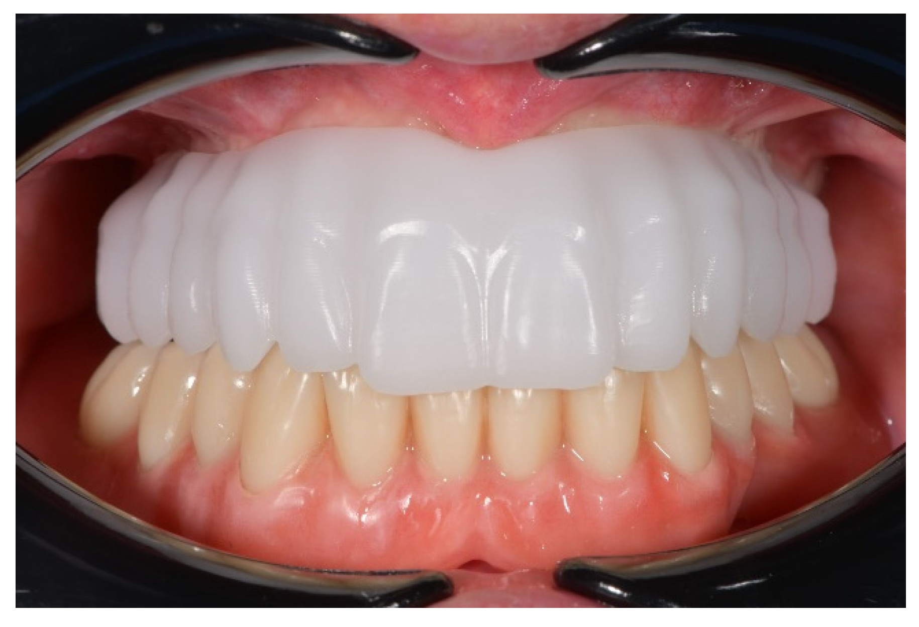 Prosthesis 04 00029 g020 Prosthesis 04 00029 g020