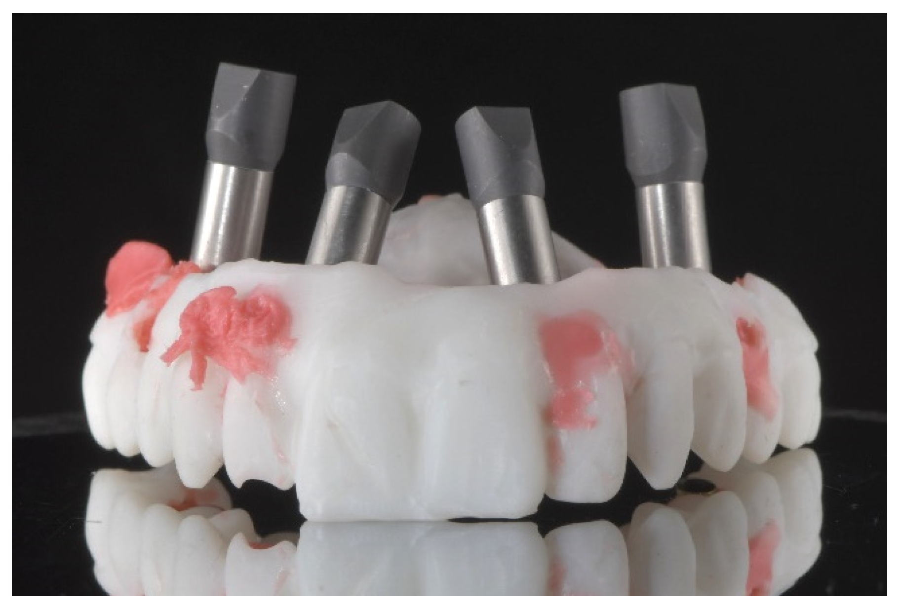 Prosthesis 04 00029 g021 Prosthesis 04 00029 g021