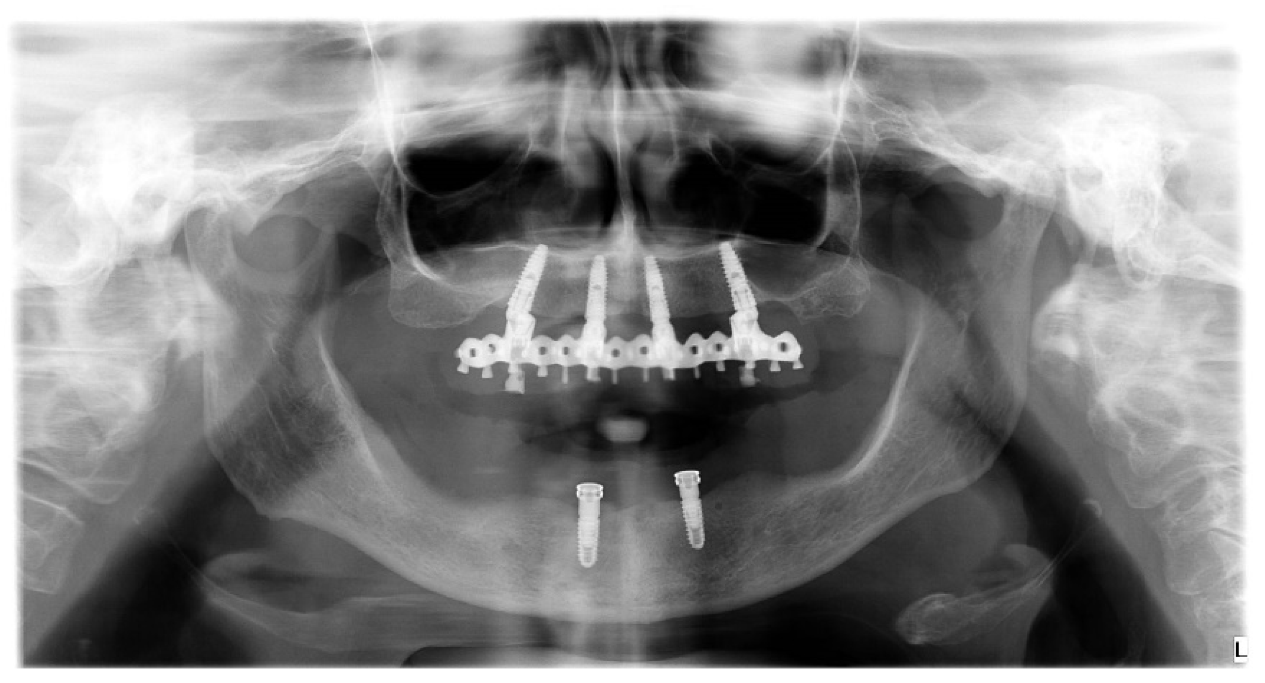 Prosthesis 04 00029 g024 Prosthesis 04 00029 g024