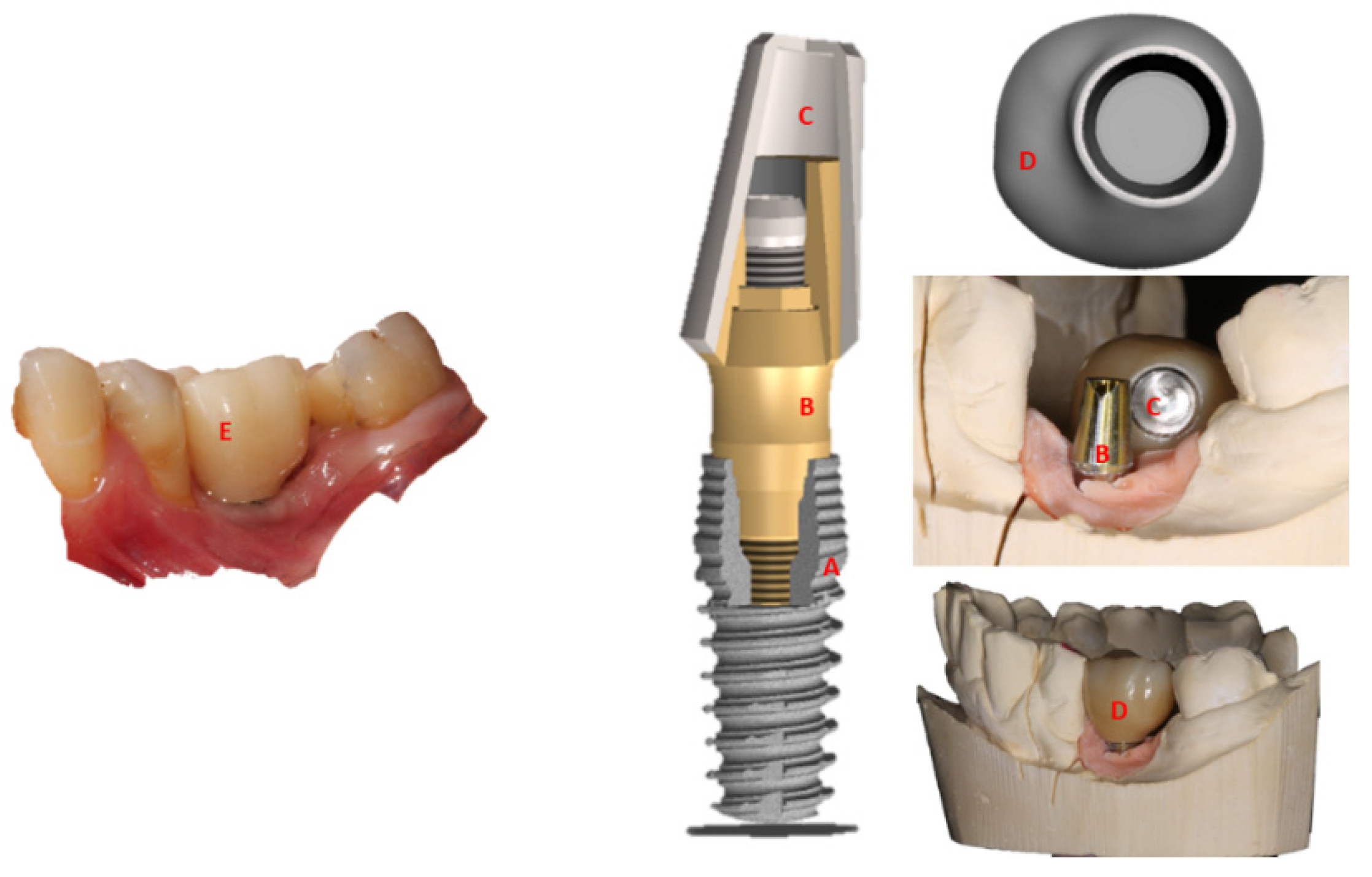 Prosthesis 04 00037 g001 Prosthesis 04 00037 g001