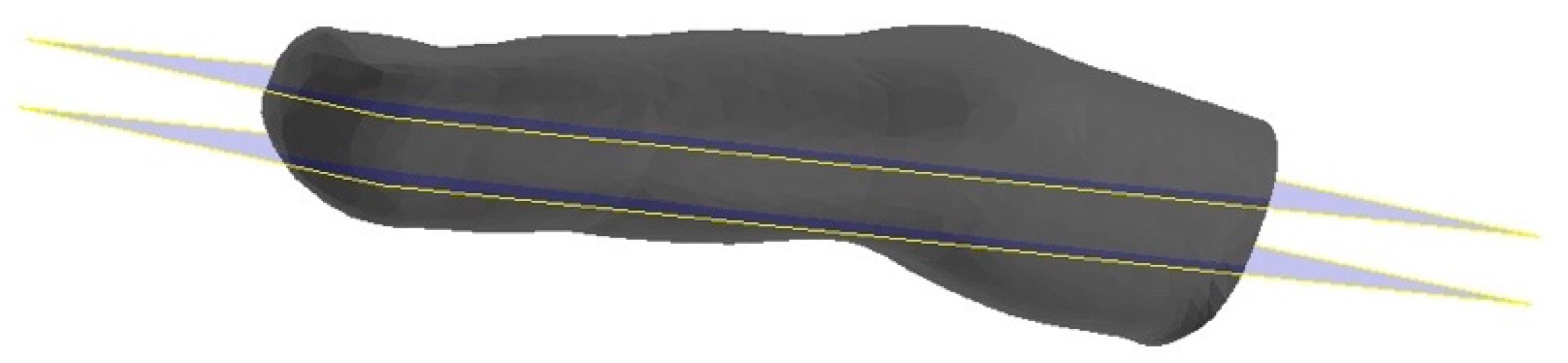 Prosthesis 04 00055 g002 Prosthesis 04 00055 g002