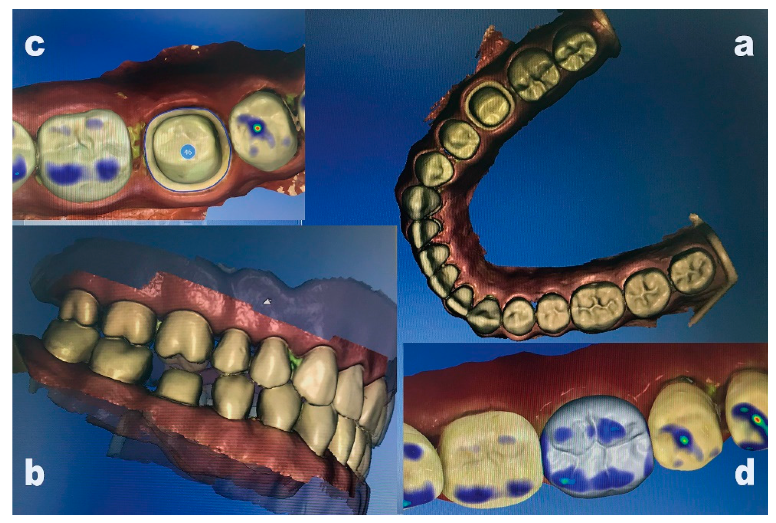 Prosthesis 05 00003 g001