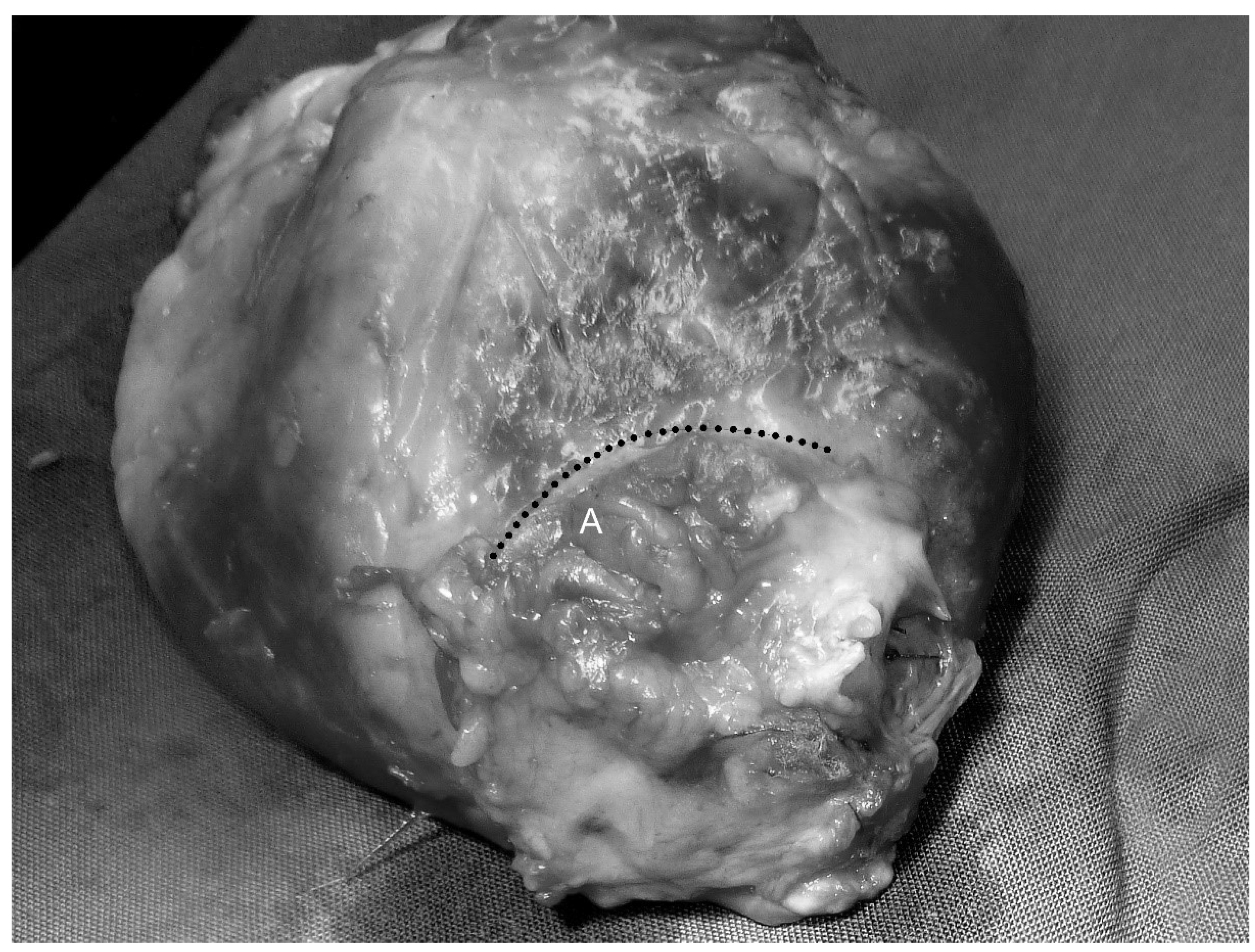 Prosthesis 05 00010 g005