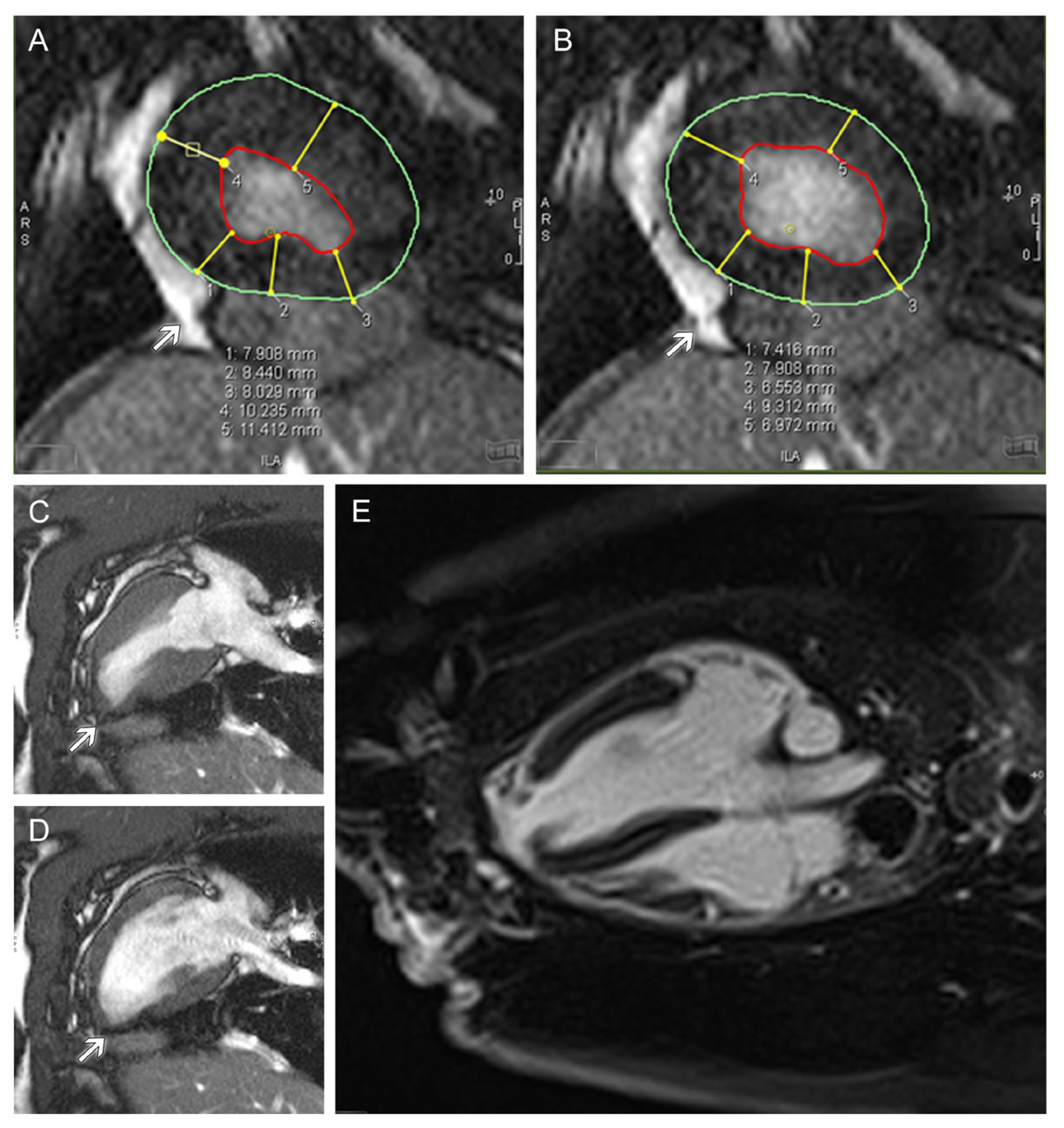 Prosthesis 05 00010 g007