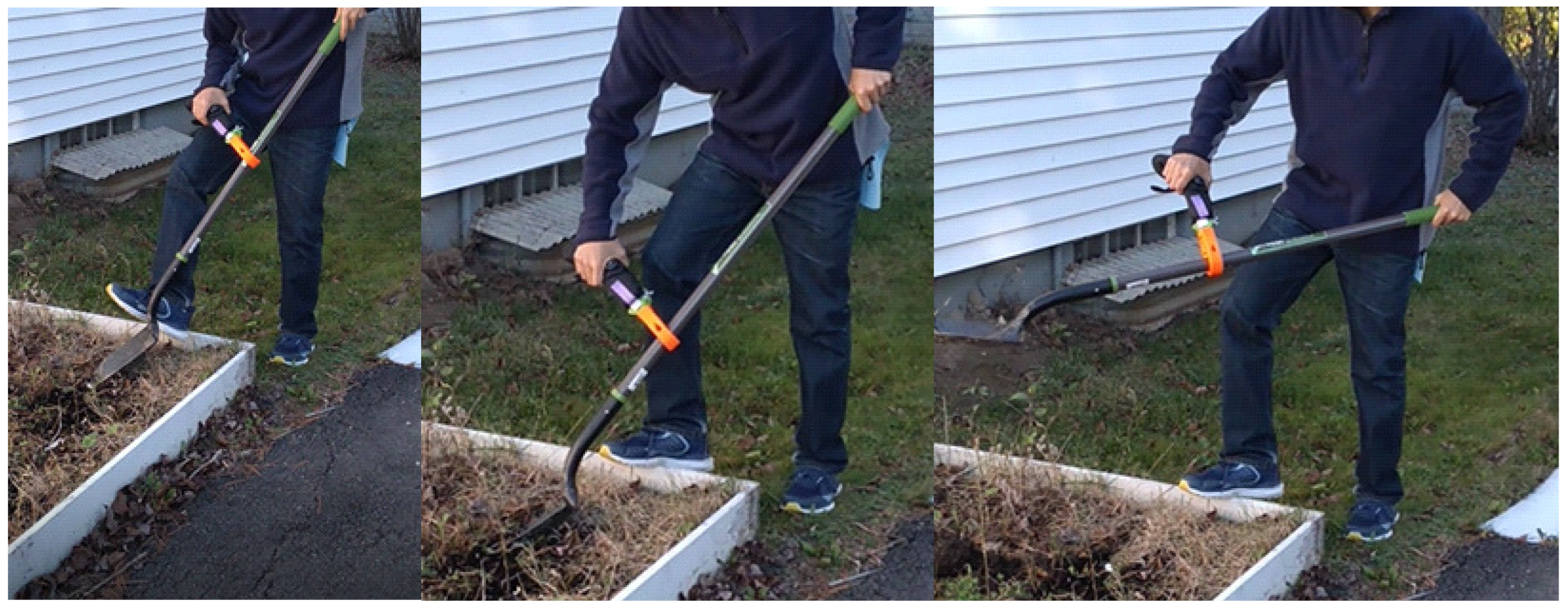 Prosthesis 05 00011 g013