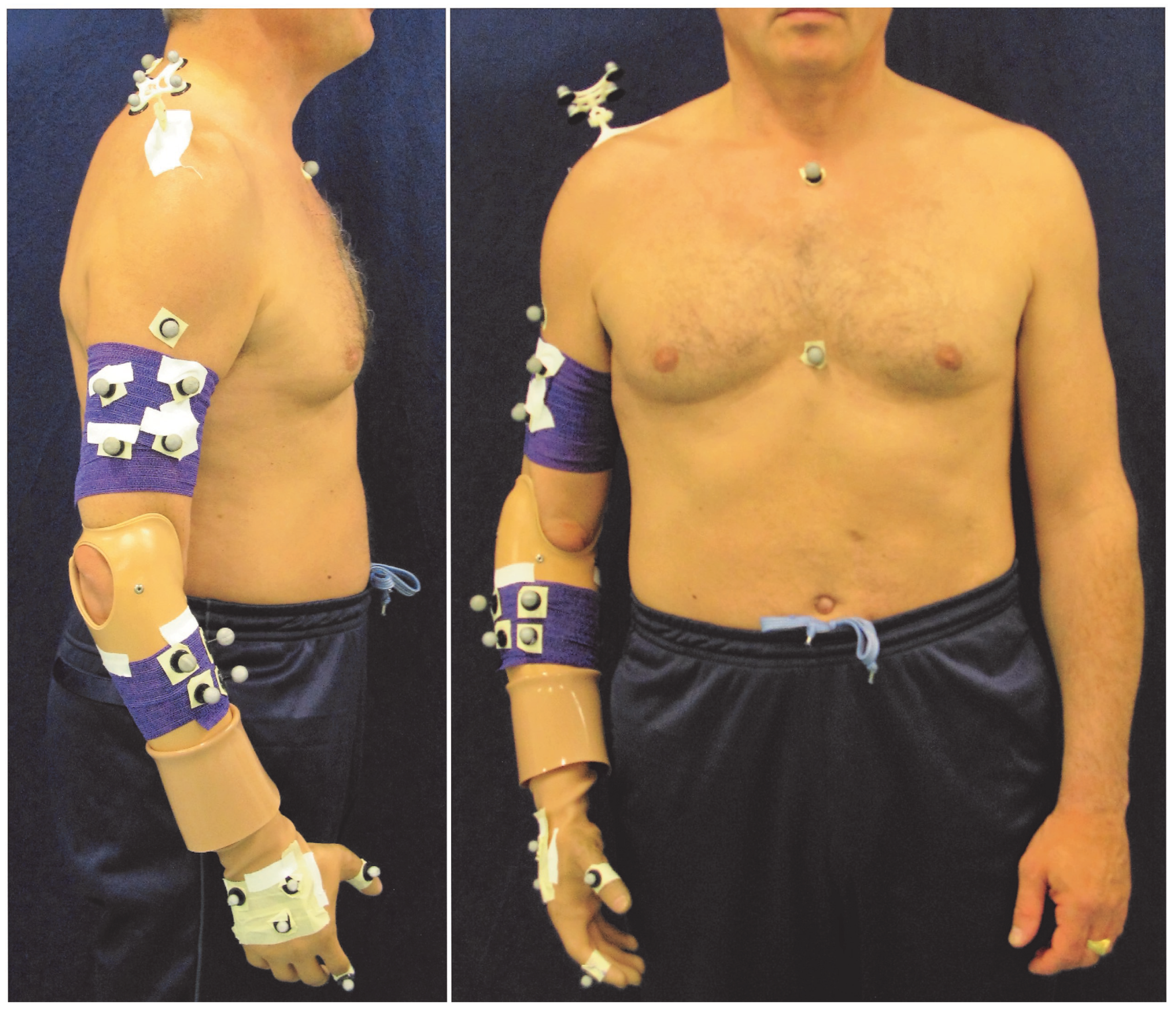 Prosthesis 05 00014 g003 Prosthesis 05 00014 g003