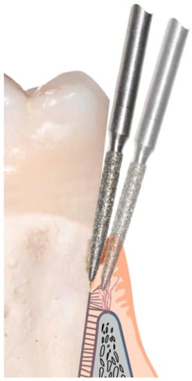 Prosthesis 05 00026 g003