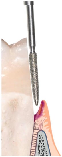 Prosthesis 05 00026 g004