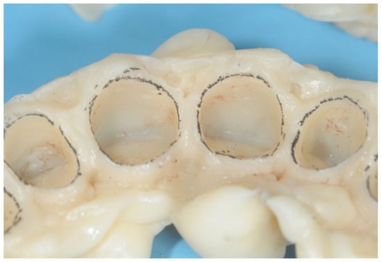 Prosthesis 05 00026 g005