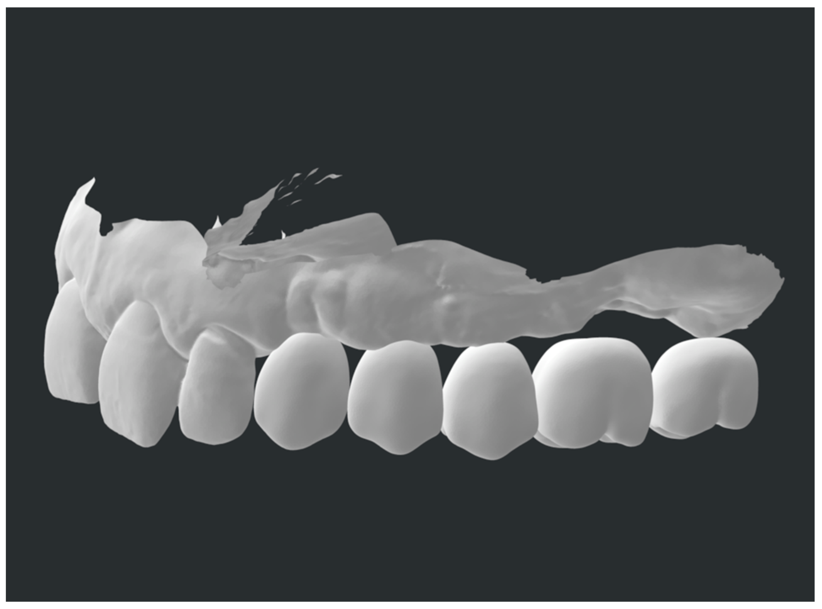 Prosthesis 05 00033 g004 Prosthesis 05 00033 g004