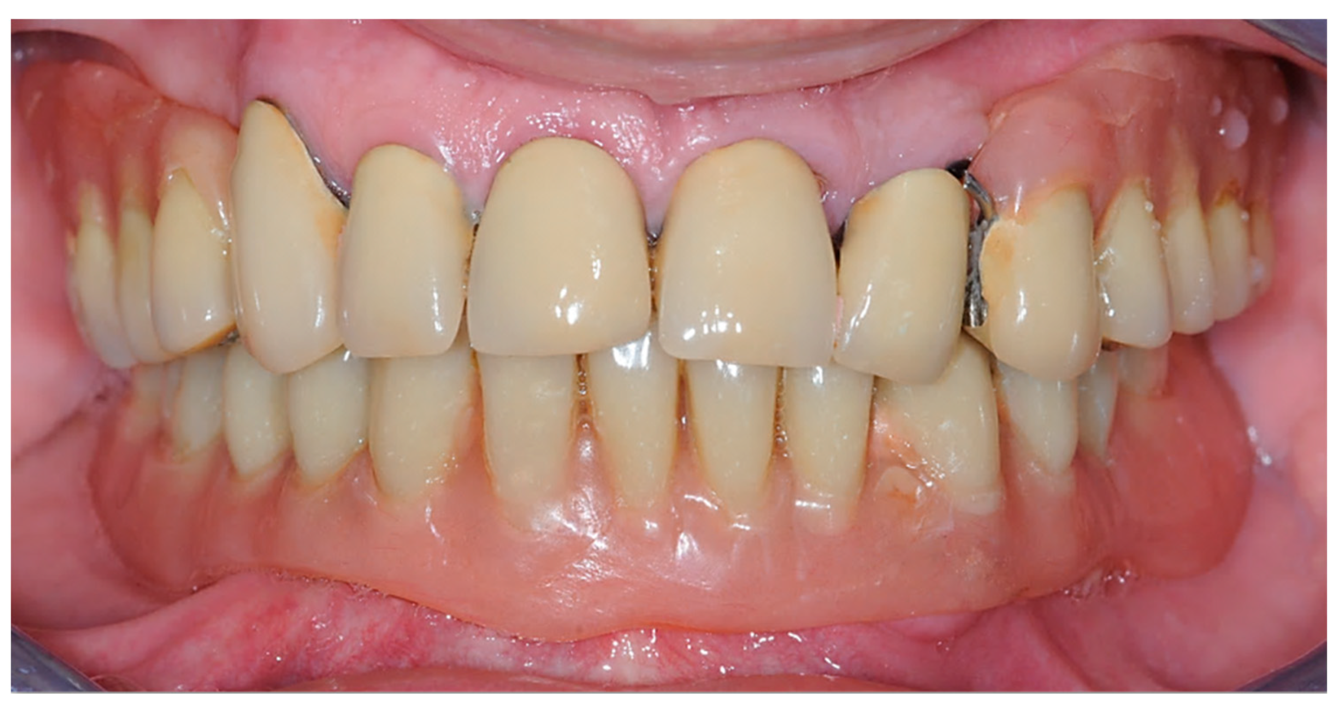 Prosthesis 05 00034 g001 Prosthesis 05 00034 g001