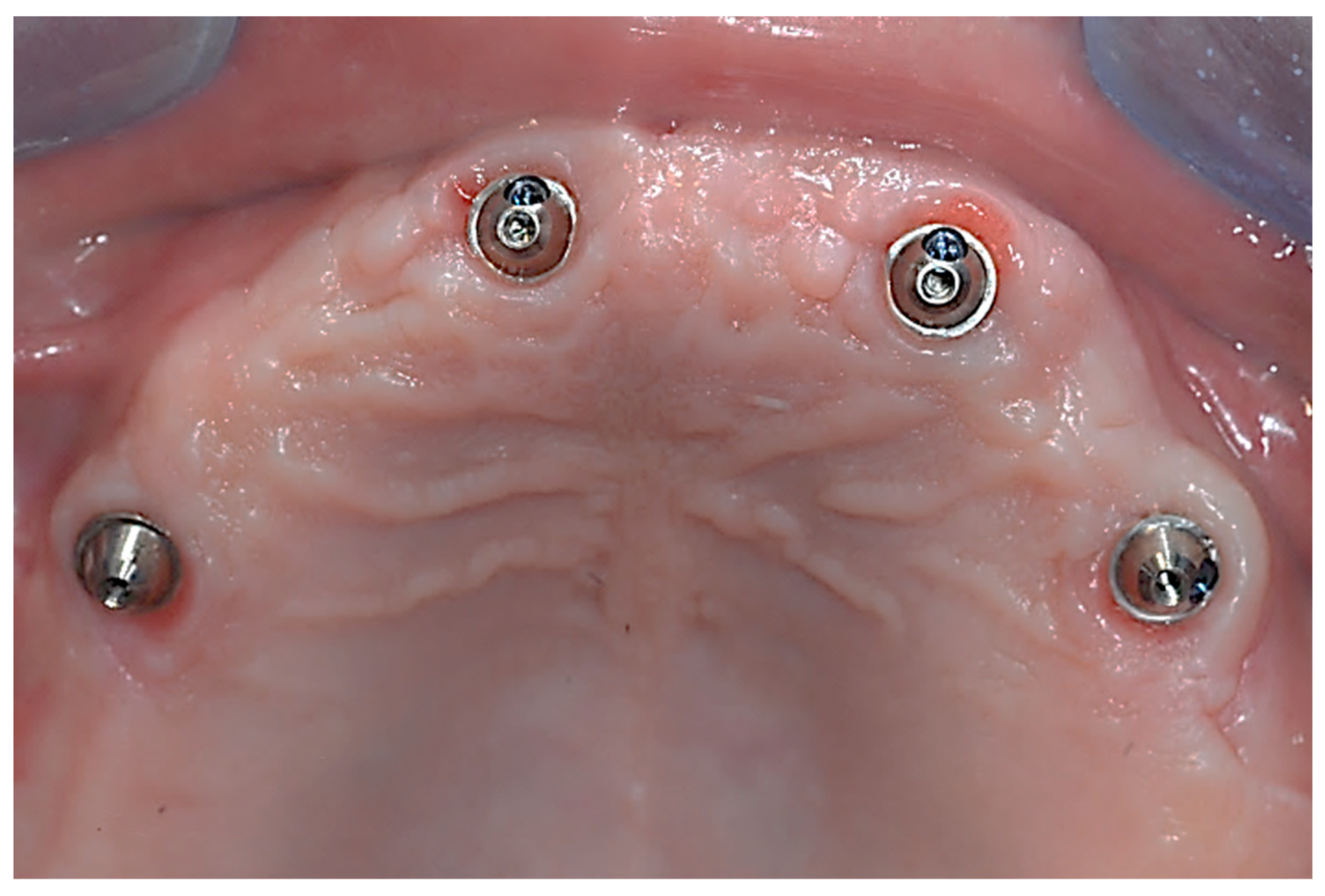 Prosthesis 05 00034 g003 Prosthesis 05 00034 g003