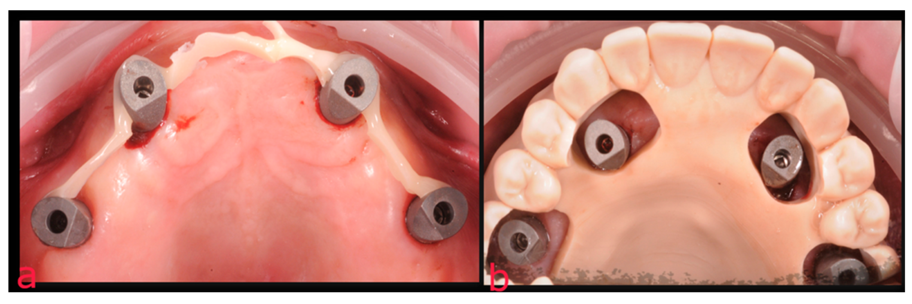 Prosthesis 05 00034 g008 Prosthesis 05 00034 g008