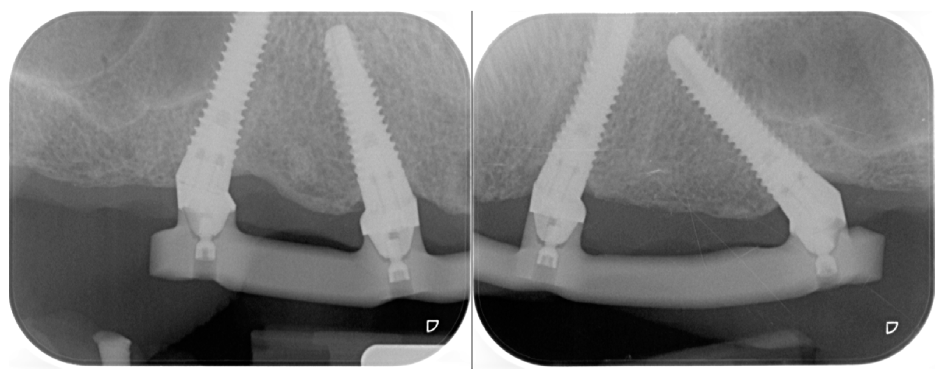 Prosthesis 05 00034 g009 Prosthesis 05 00034 g009