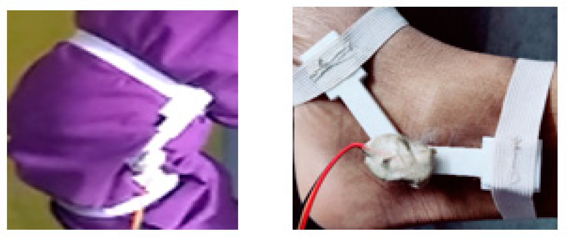 Prosthesis 05 00040 g002