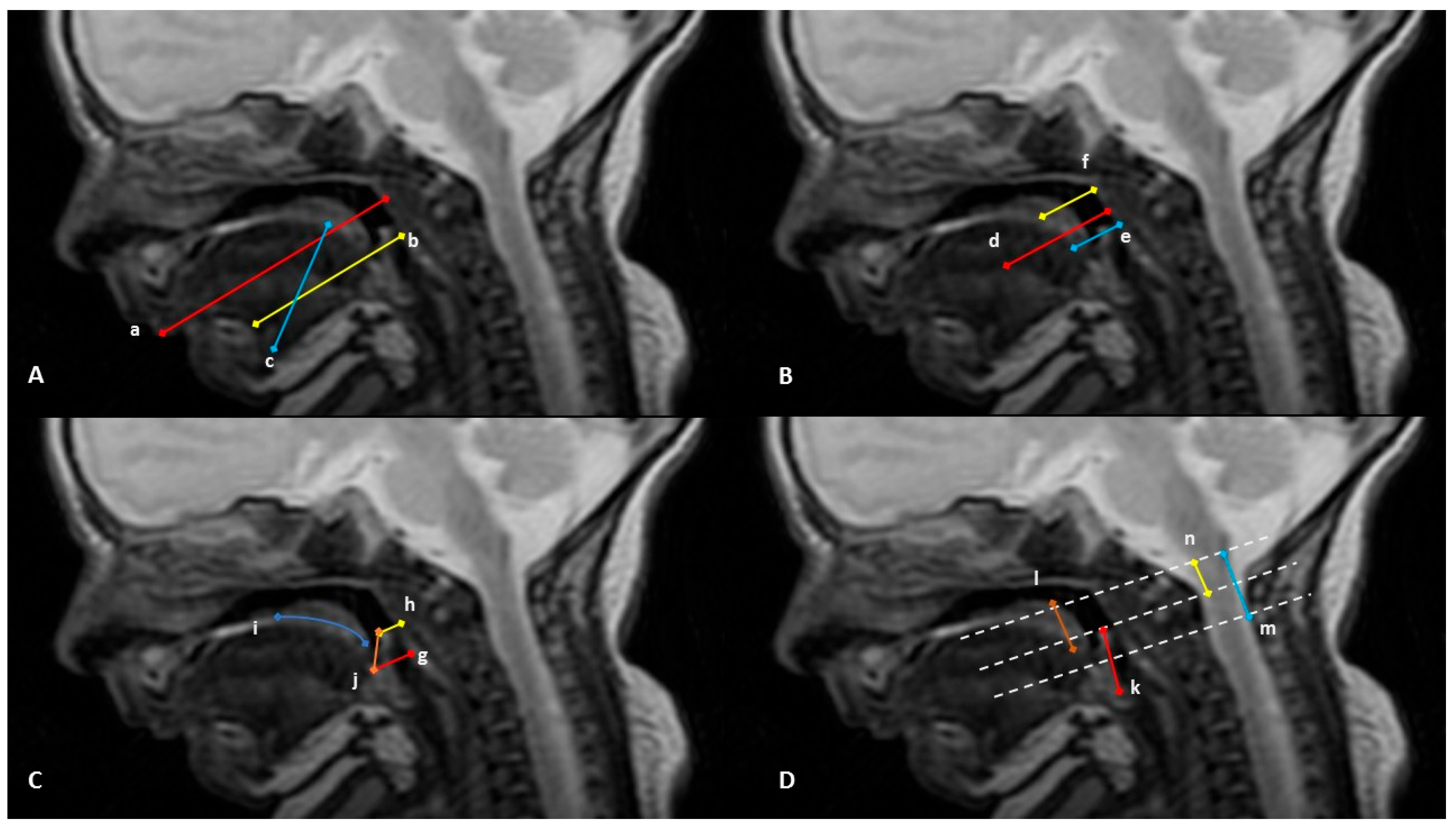 Prosthesis 05 00042 g002