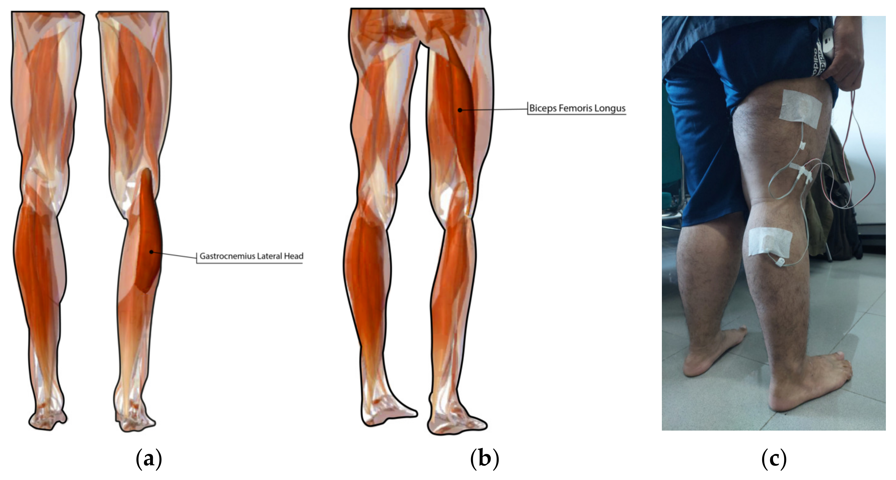 Prosthesis 05 00046 g002 Prosthesis 05 00046 g002