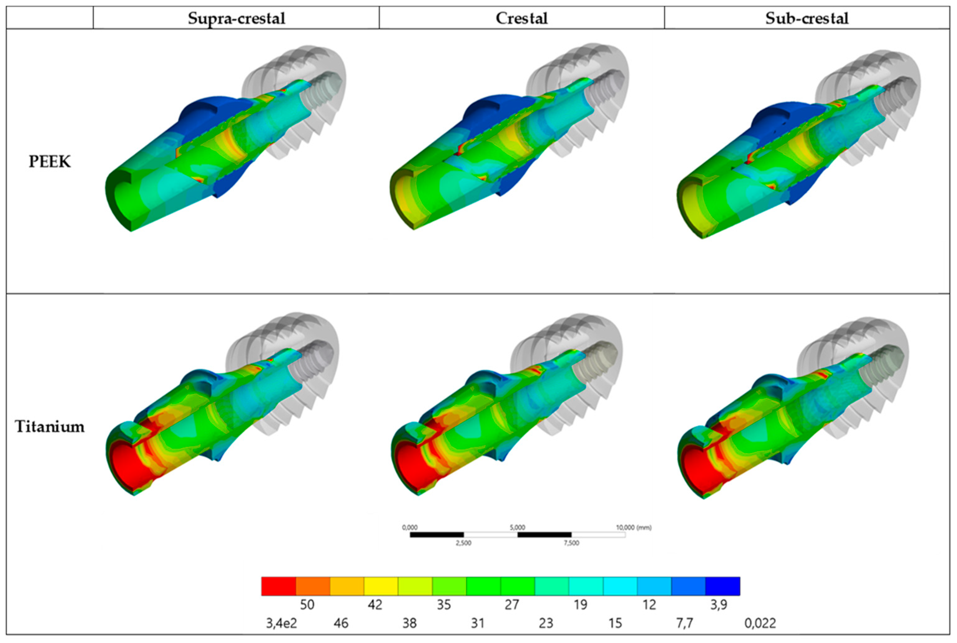 Prosthesis 05 00051 g005
