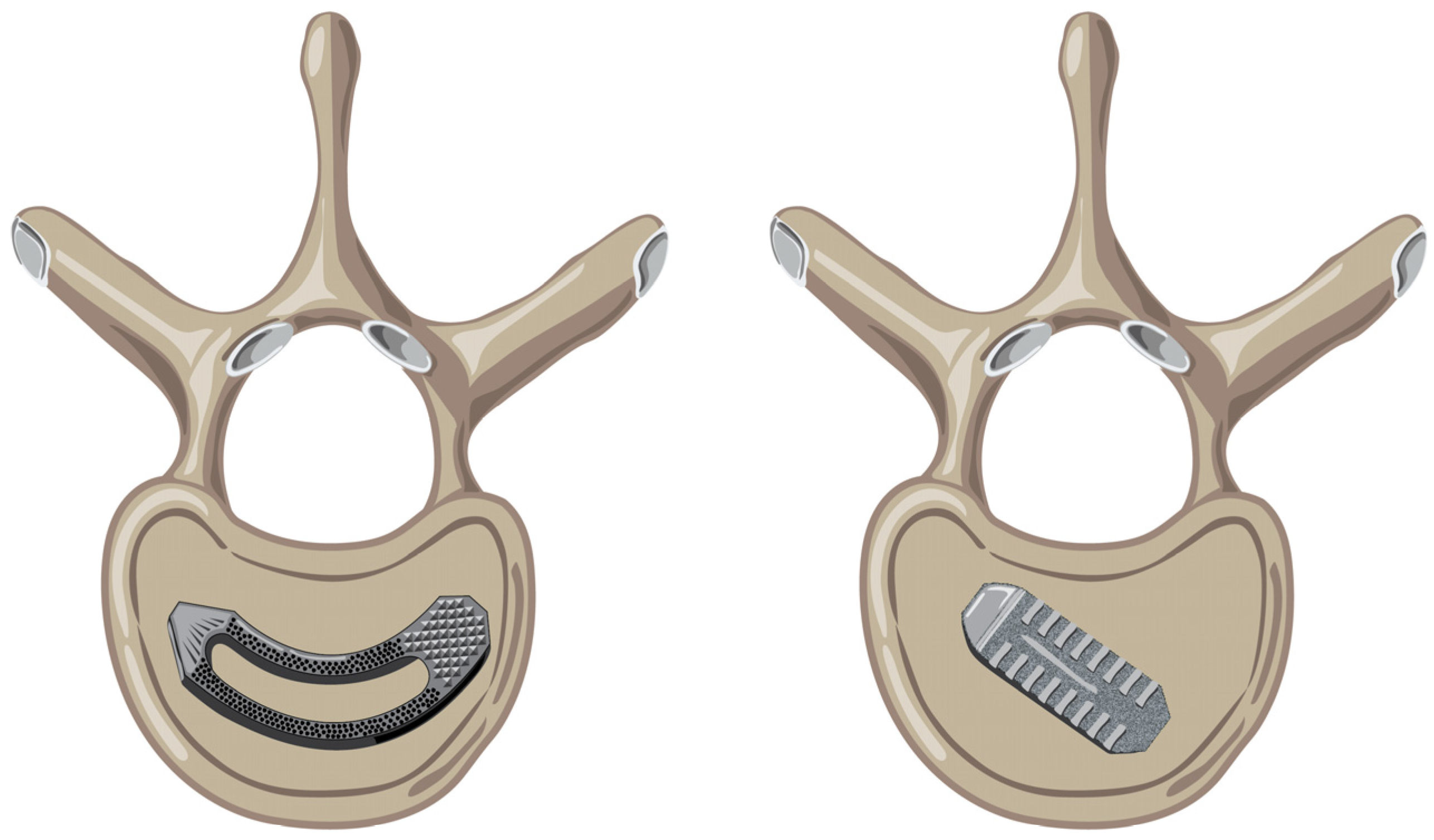 Prosthesis 05 00053 g001