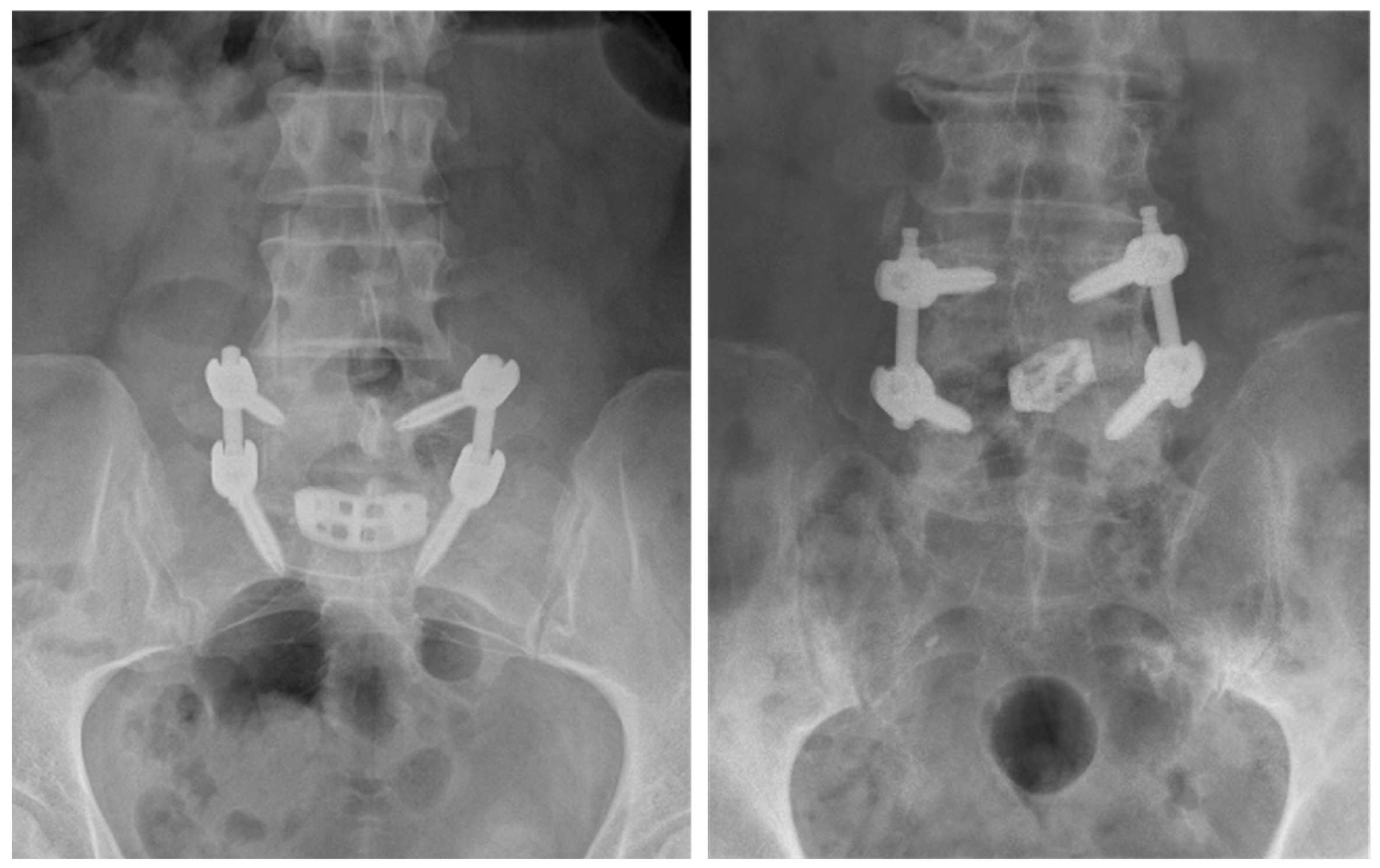 Prosthesis 05 00053 g002