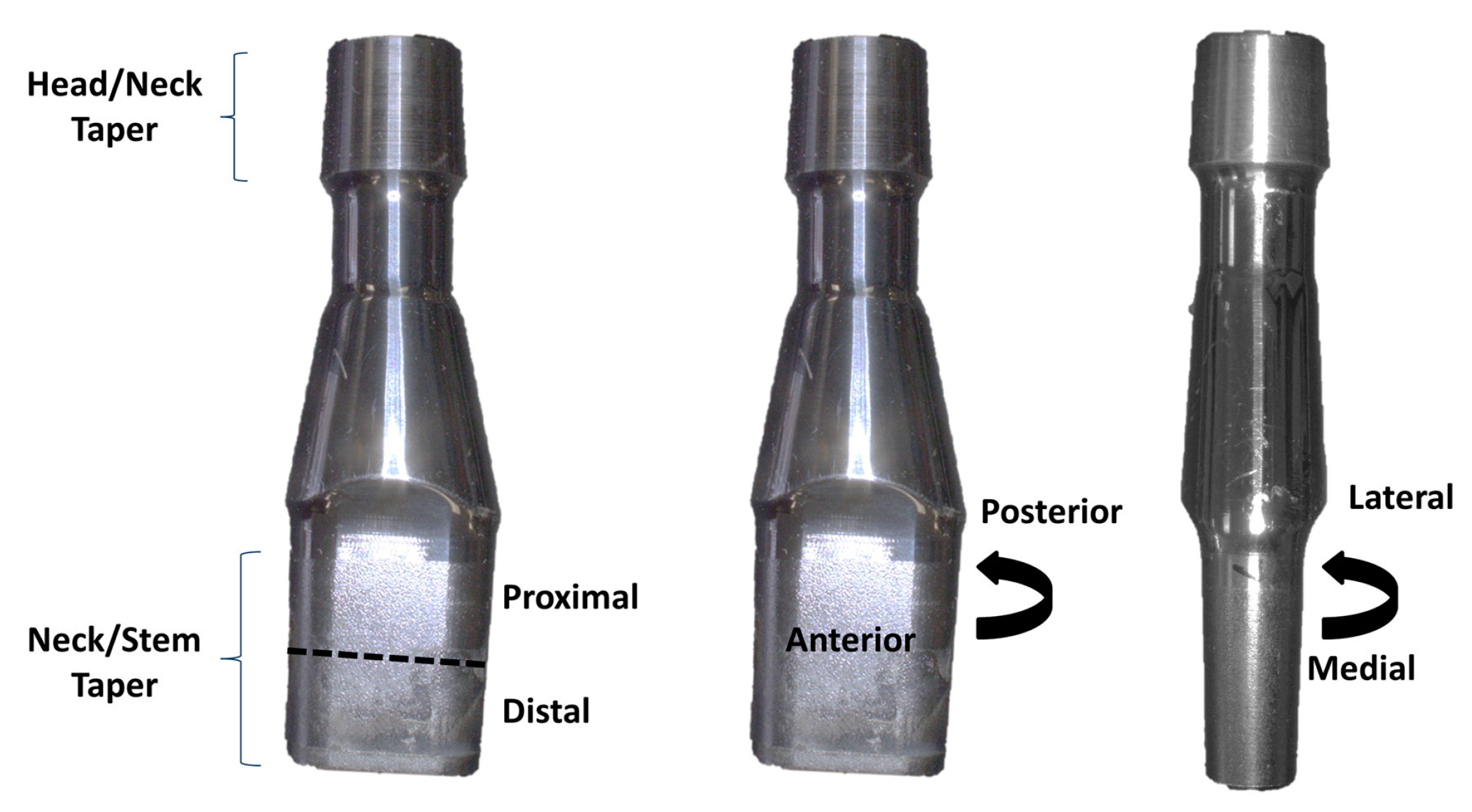 Prosthesis 05 00055 g003 Prosthesis 05 00055 g003