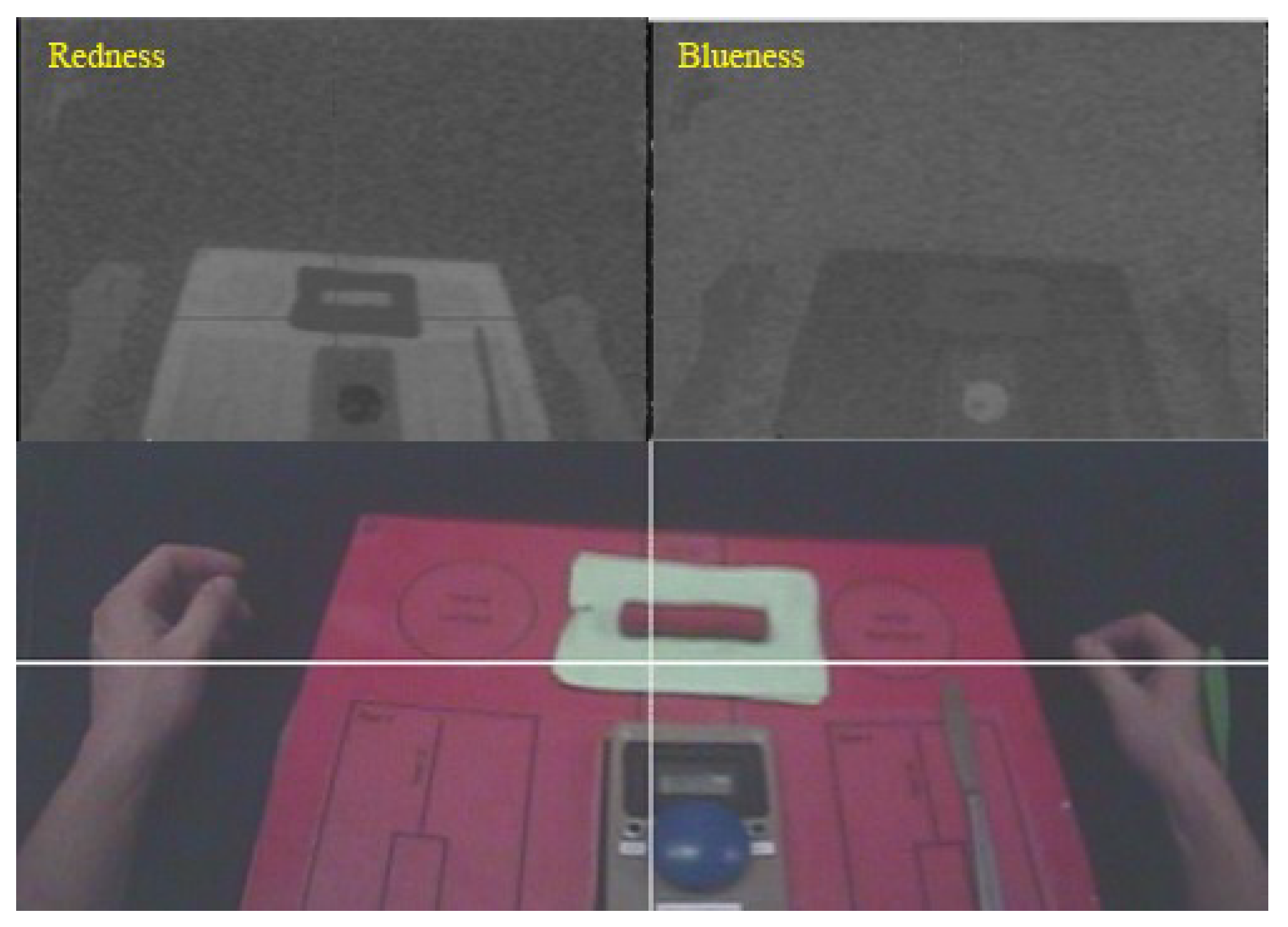 Prosthesis 05 00063 g006