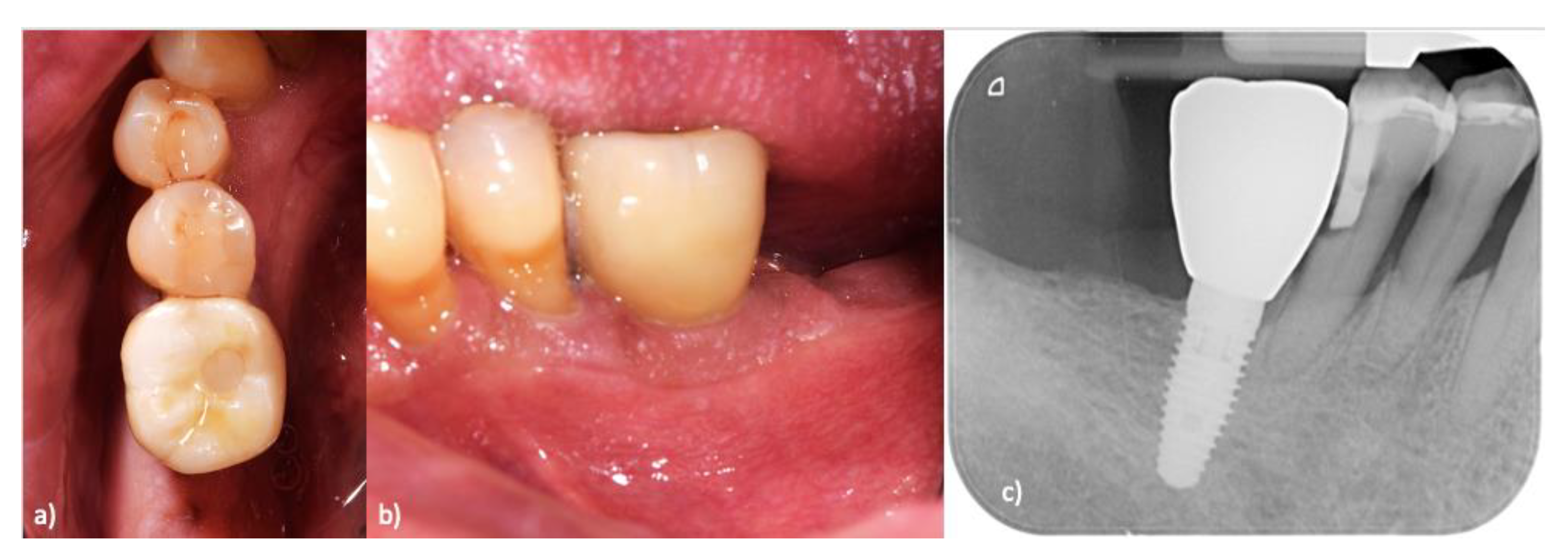 Prosthesis 05 00072 g004